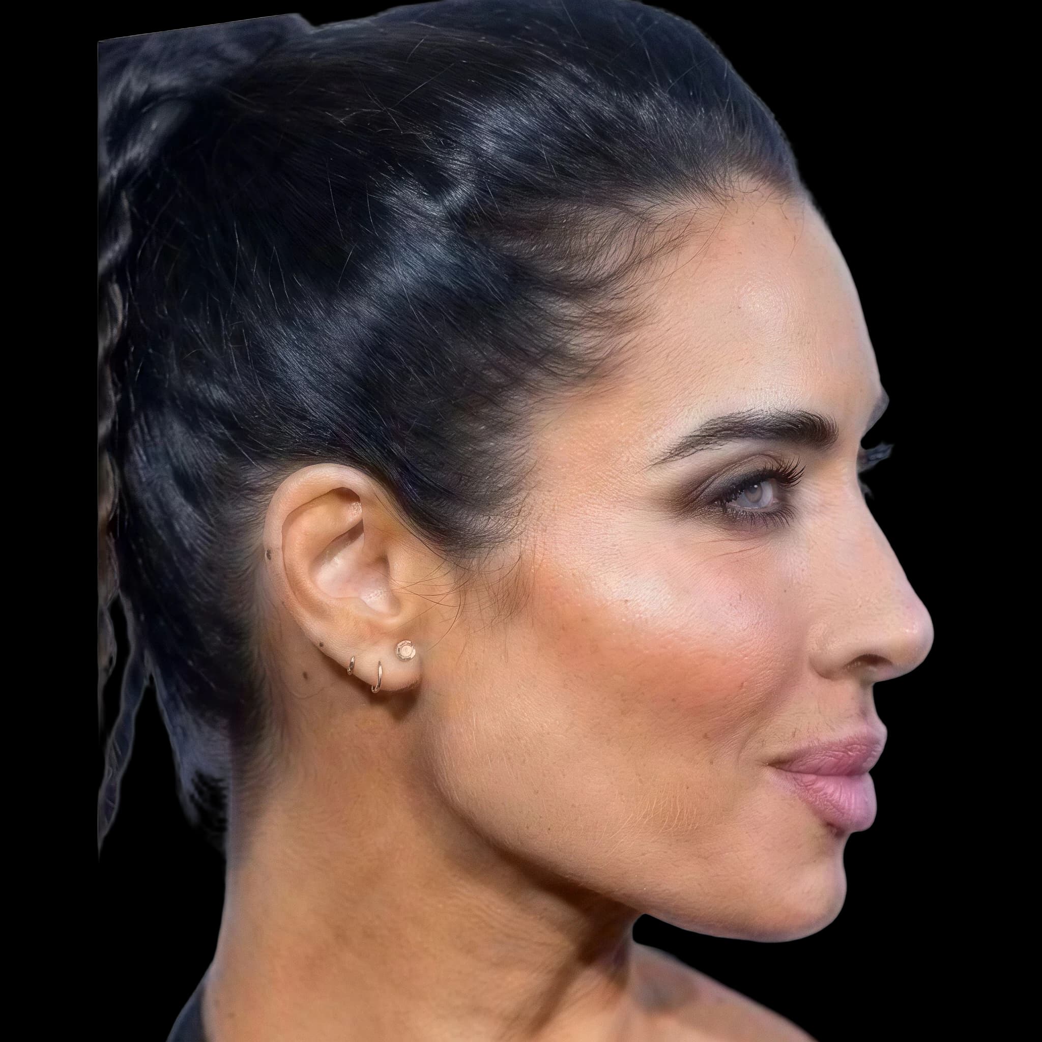 Pilar Rubio, Submental Definition