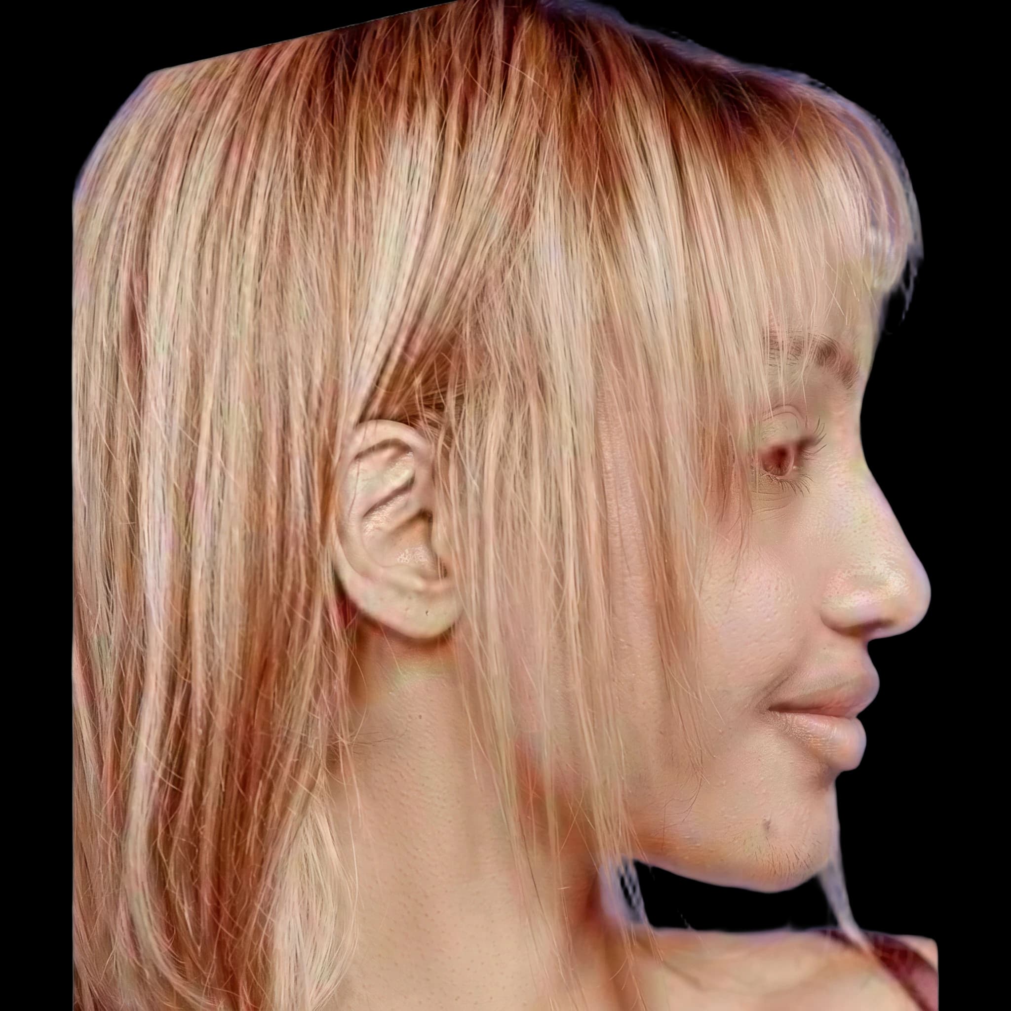 Pink Pantheress, Interior Midface Projection Angle