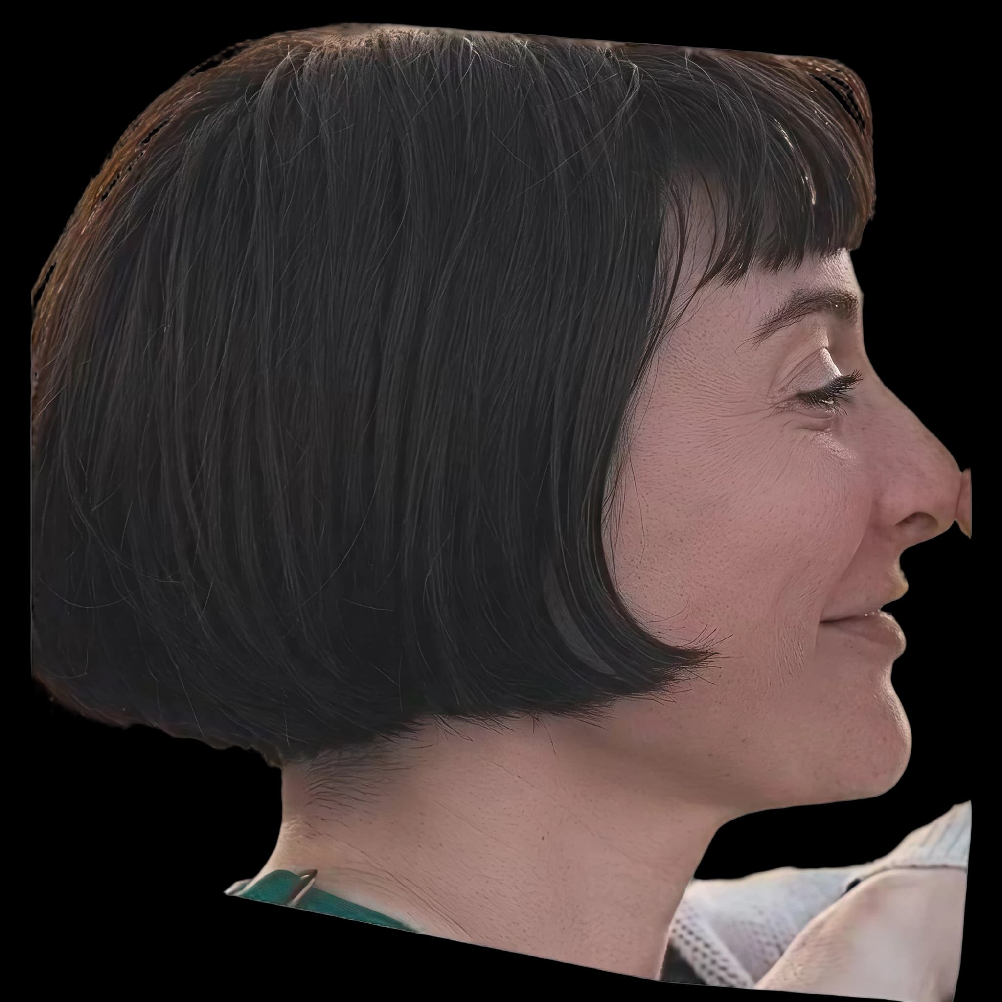 Qveen Herby, Nasofrontal Angle