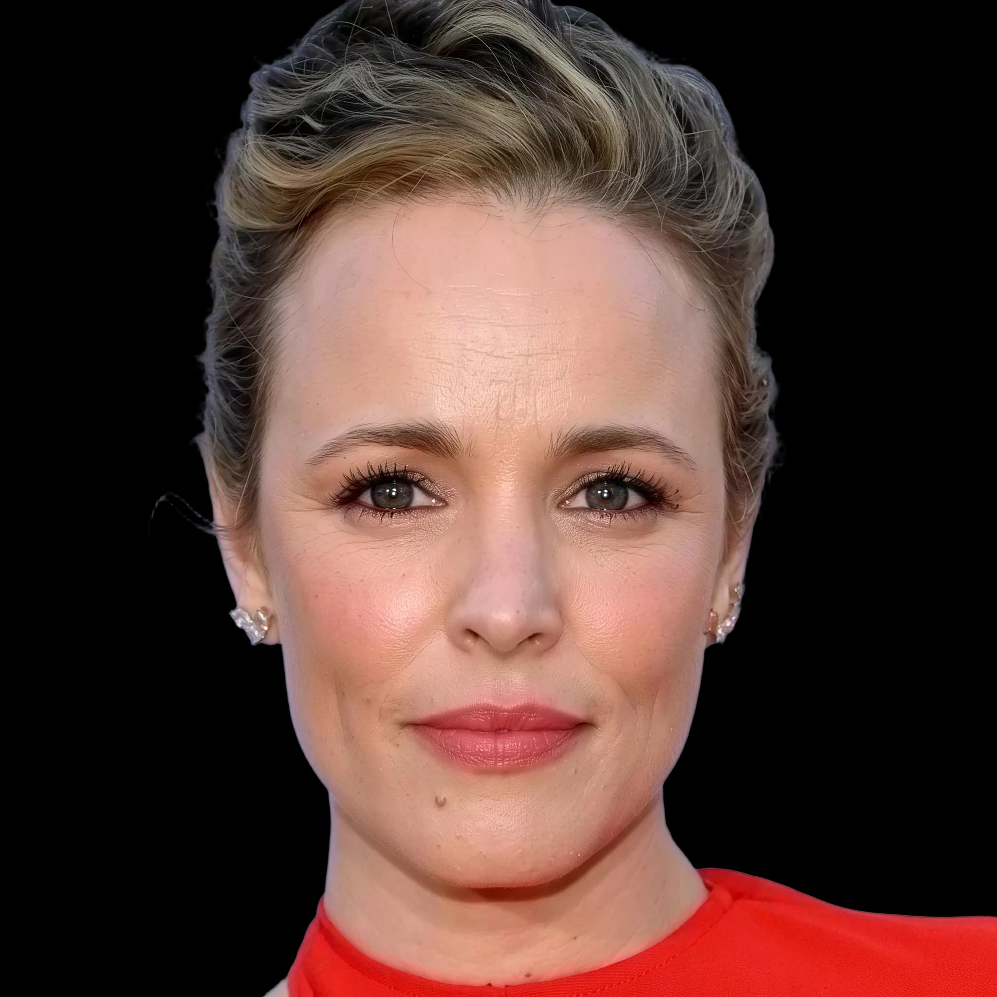 Rachel McAdams, Hyperpigmentation