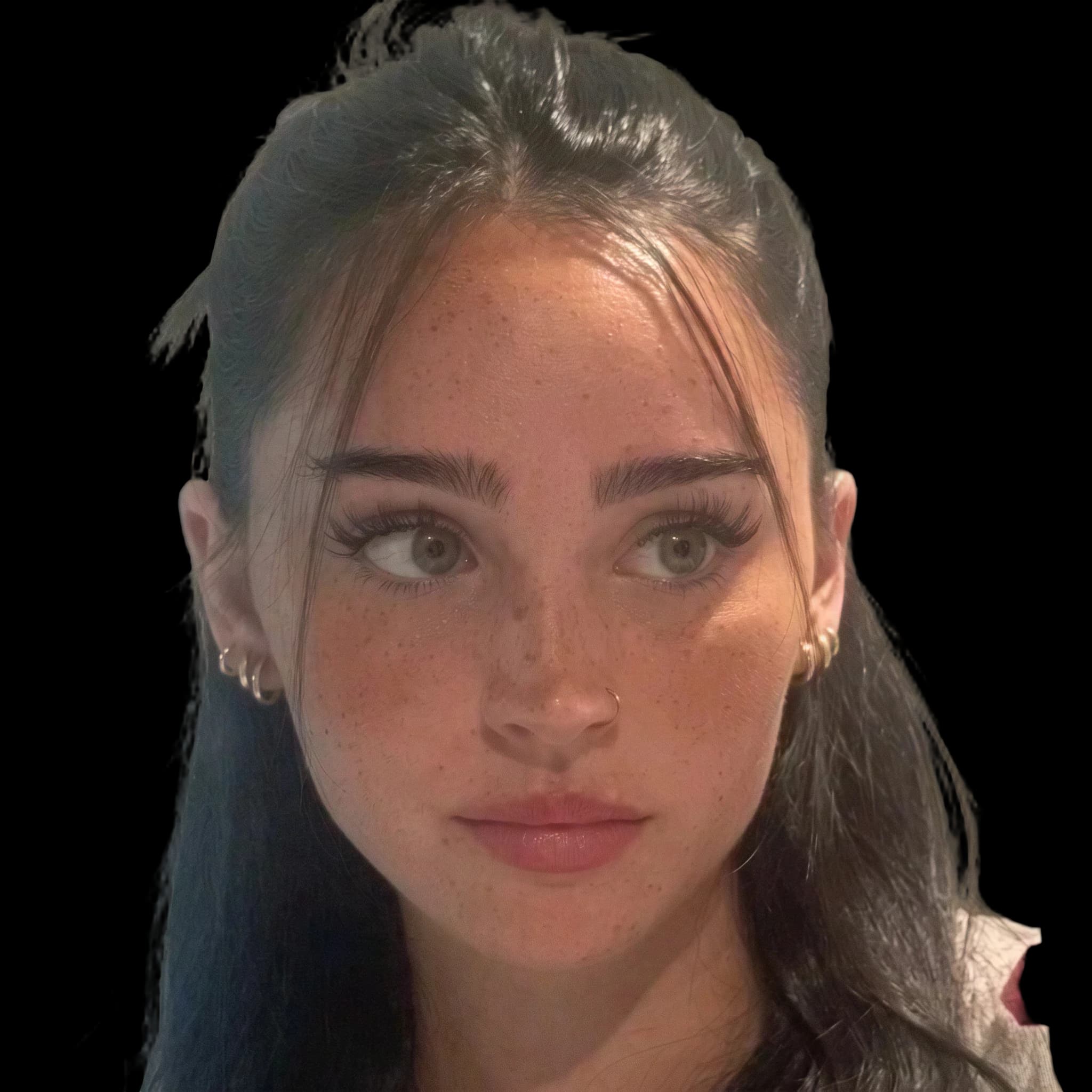 Rae Cambra, Hyperpigmentation