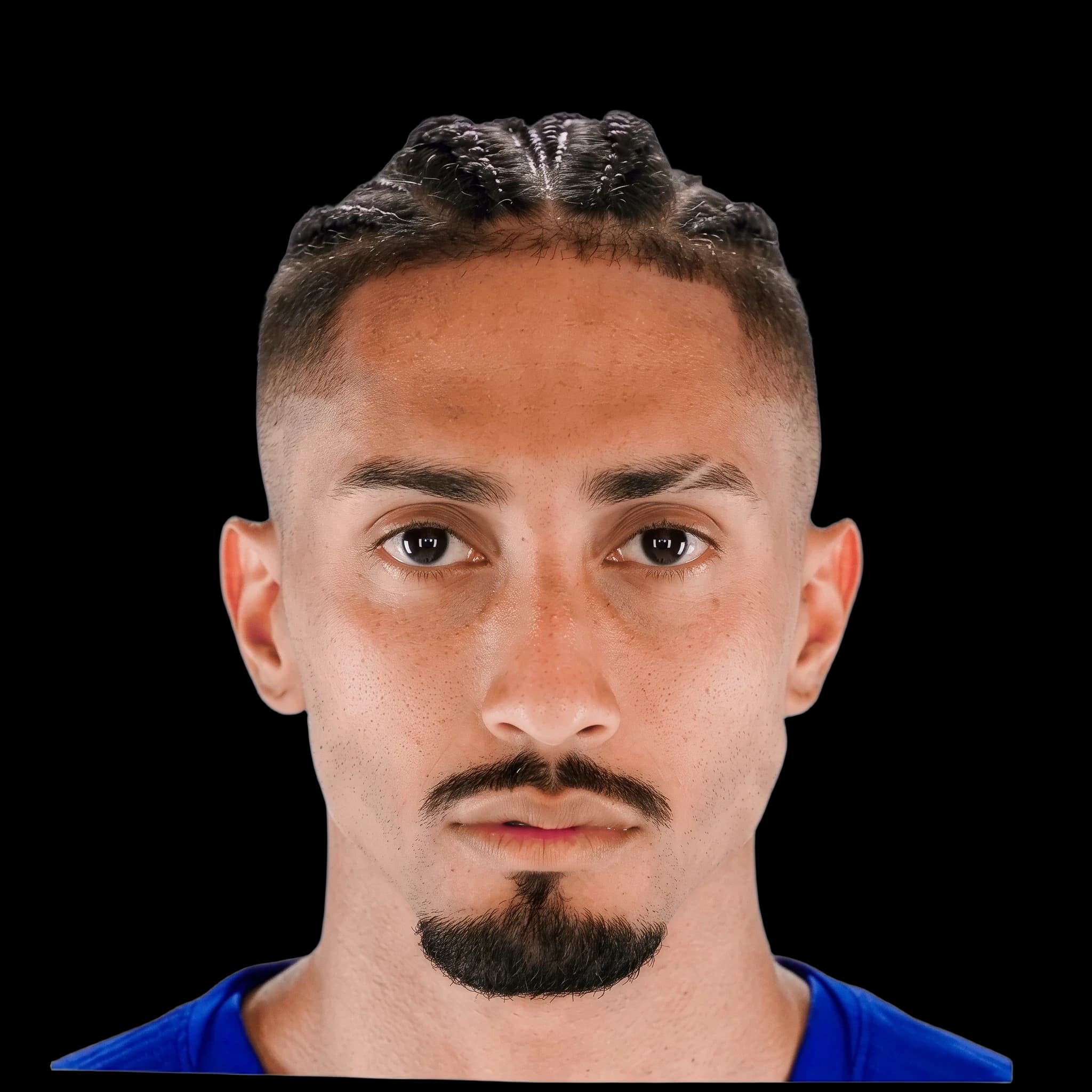 Raphael Dias Belloli, Hypopigmentation