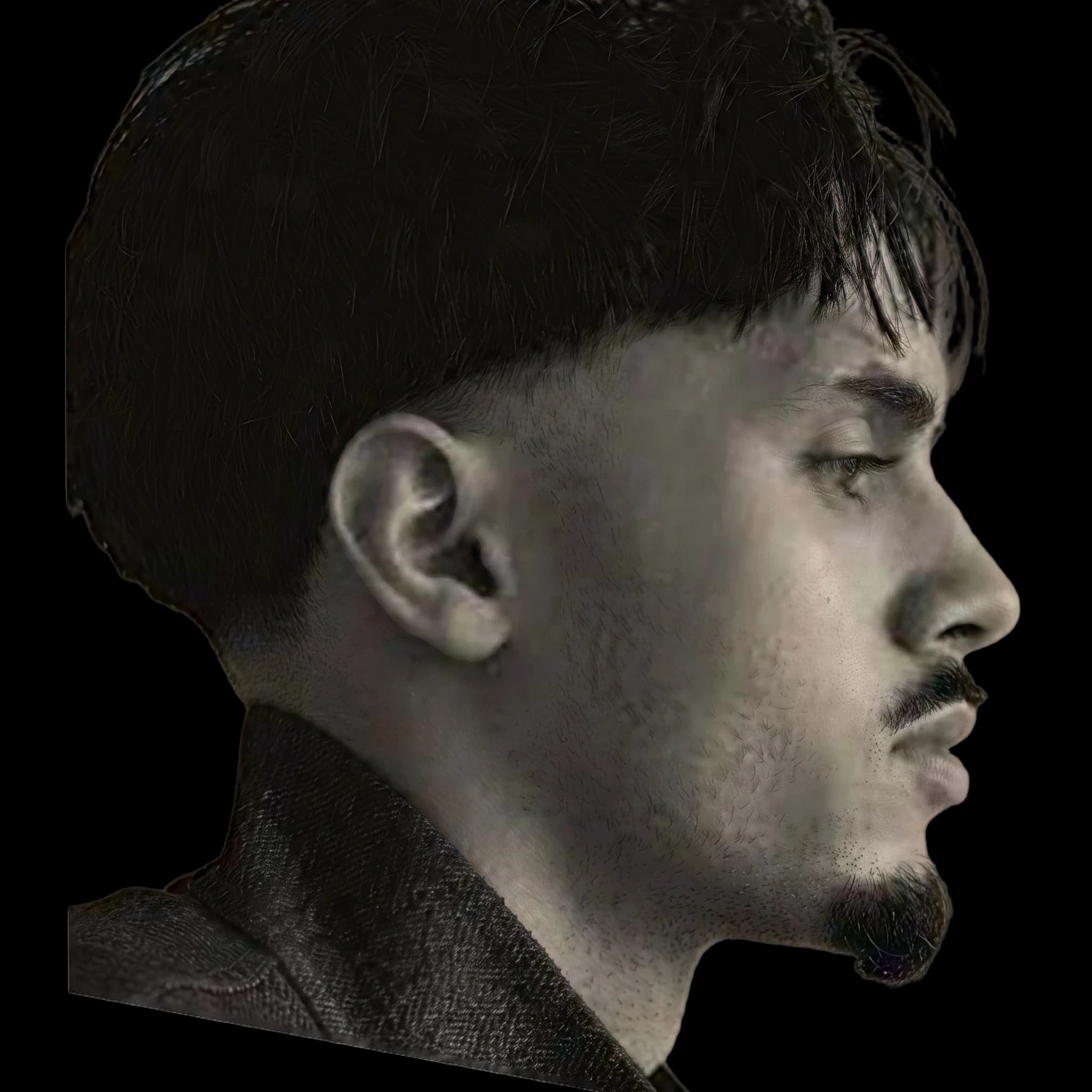 Rnboi, Upper Lip E-Line Position
