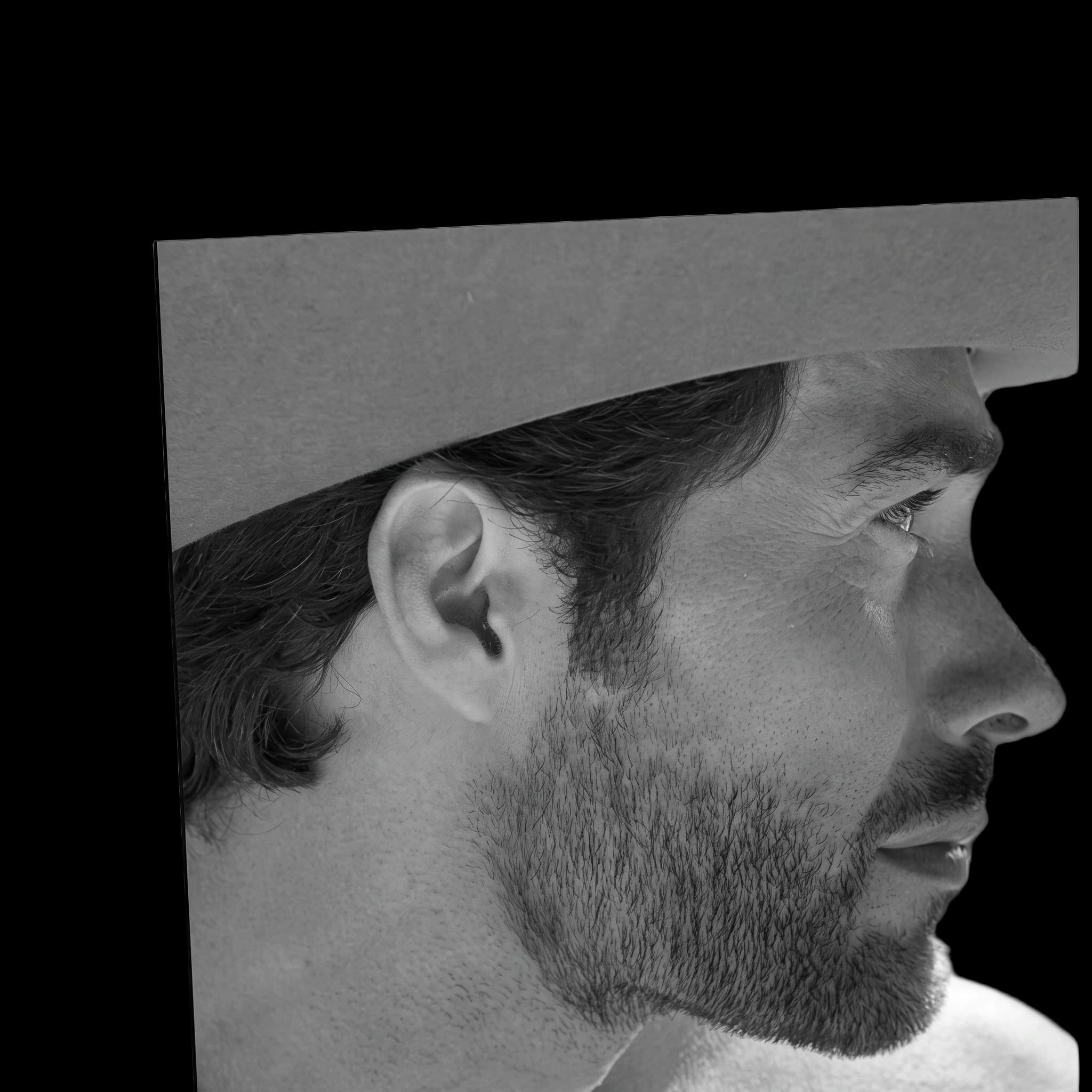Rodrigo Guirao, Nasal Tip Angle