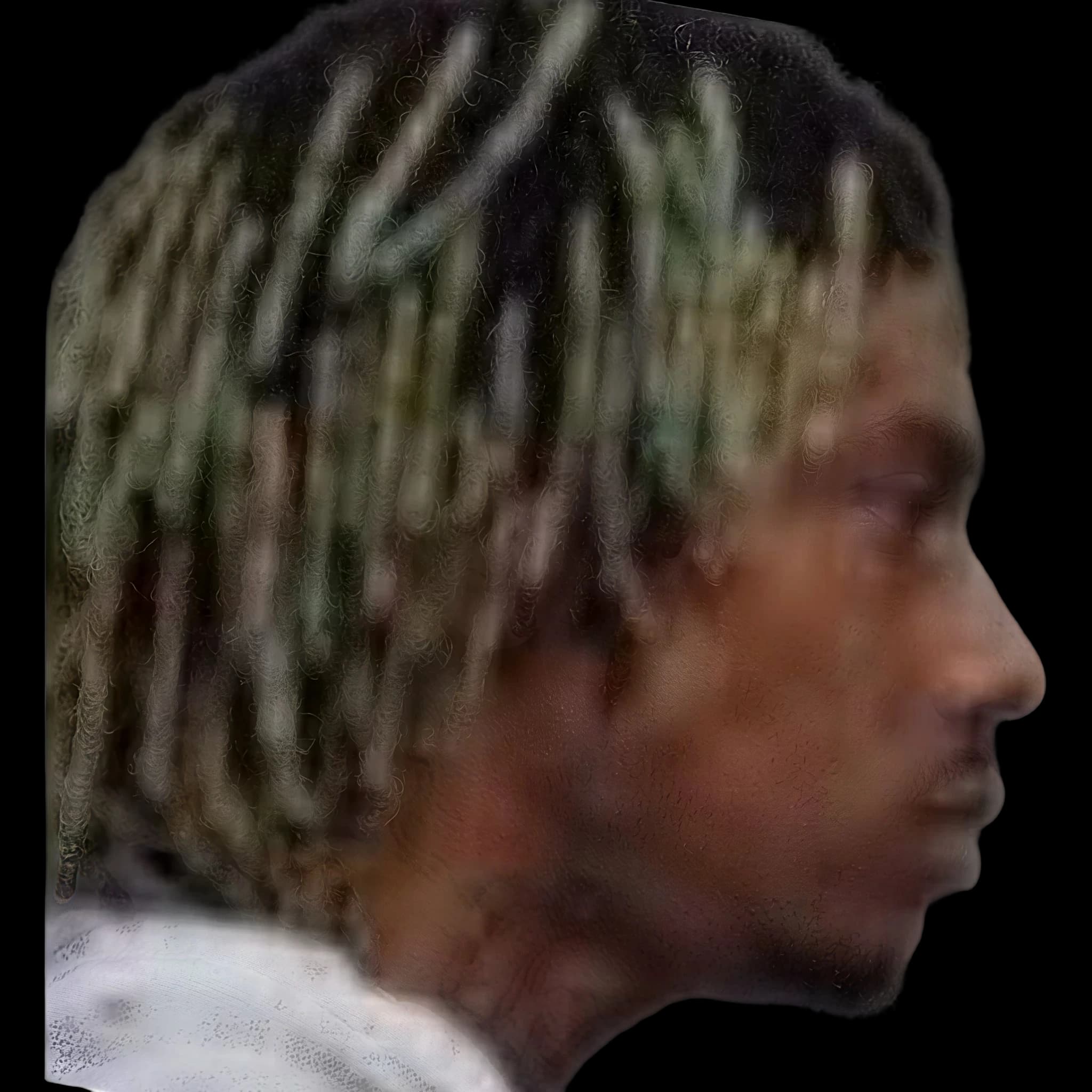Ruben Slikk, Gonial Angle
