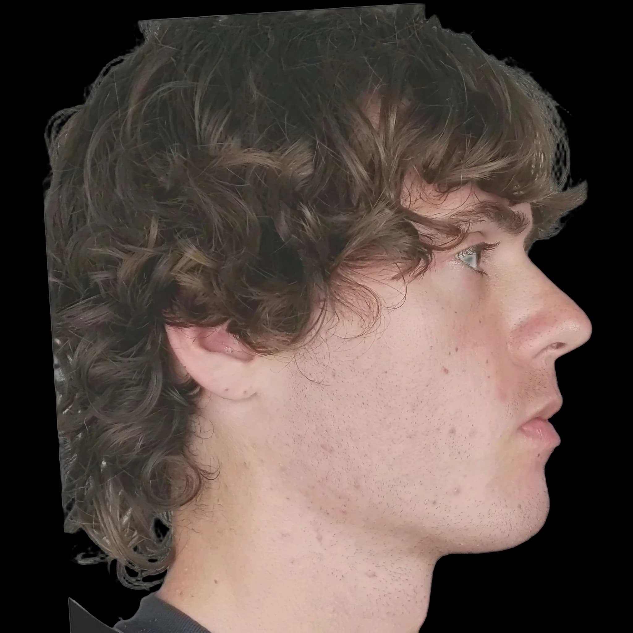 Rubenmaxxing(LooksMaxxer Influencer), Submental Definition