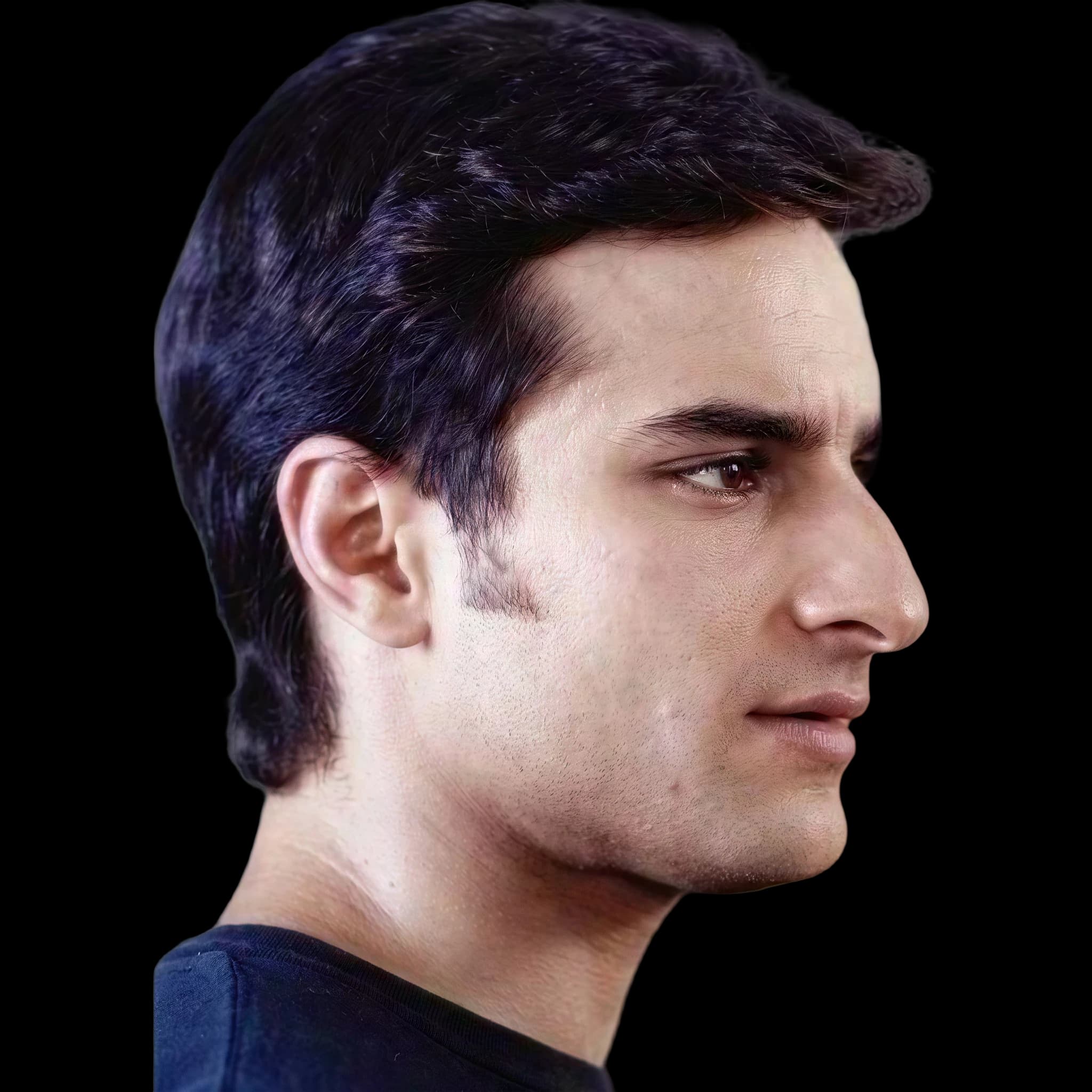 Saif Ali Khan, Interior Midface Projection Angle
