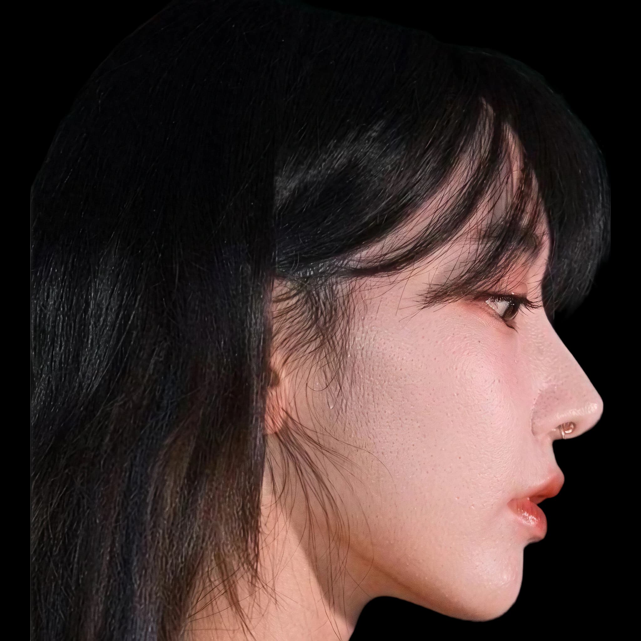 Sakura Miyawaki, Mandibular Plane Angle