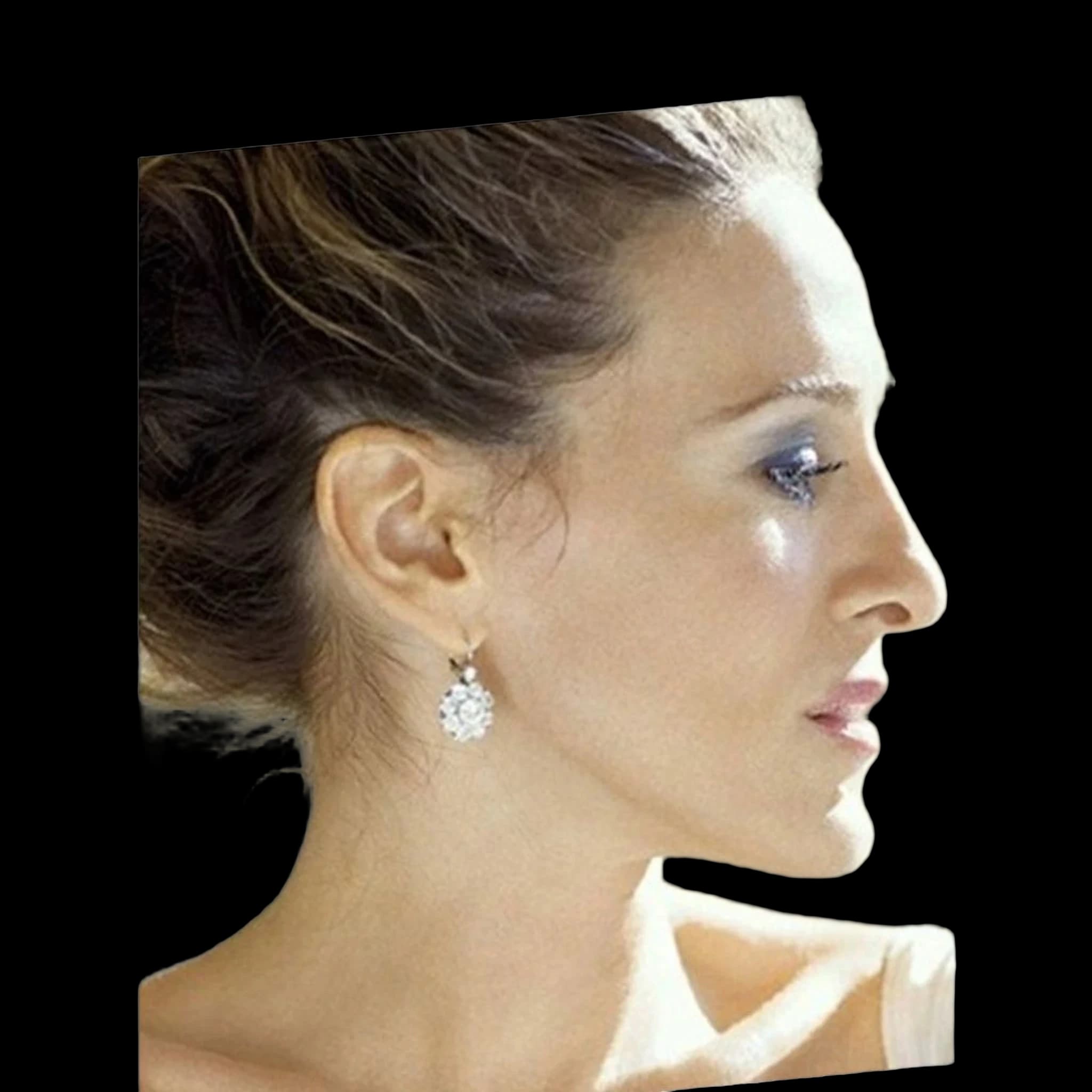 Sarah Jessica Parker, Upper Lip E-Line Position