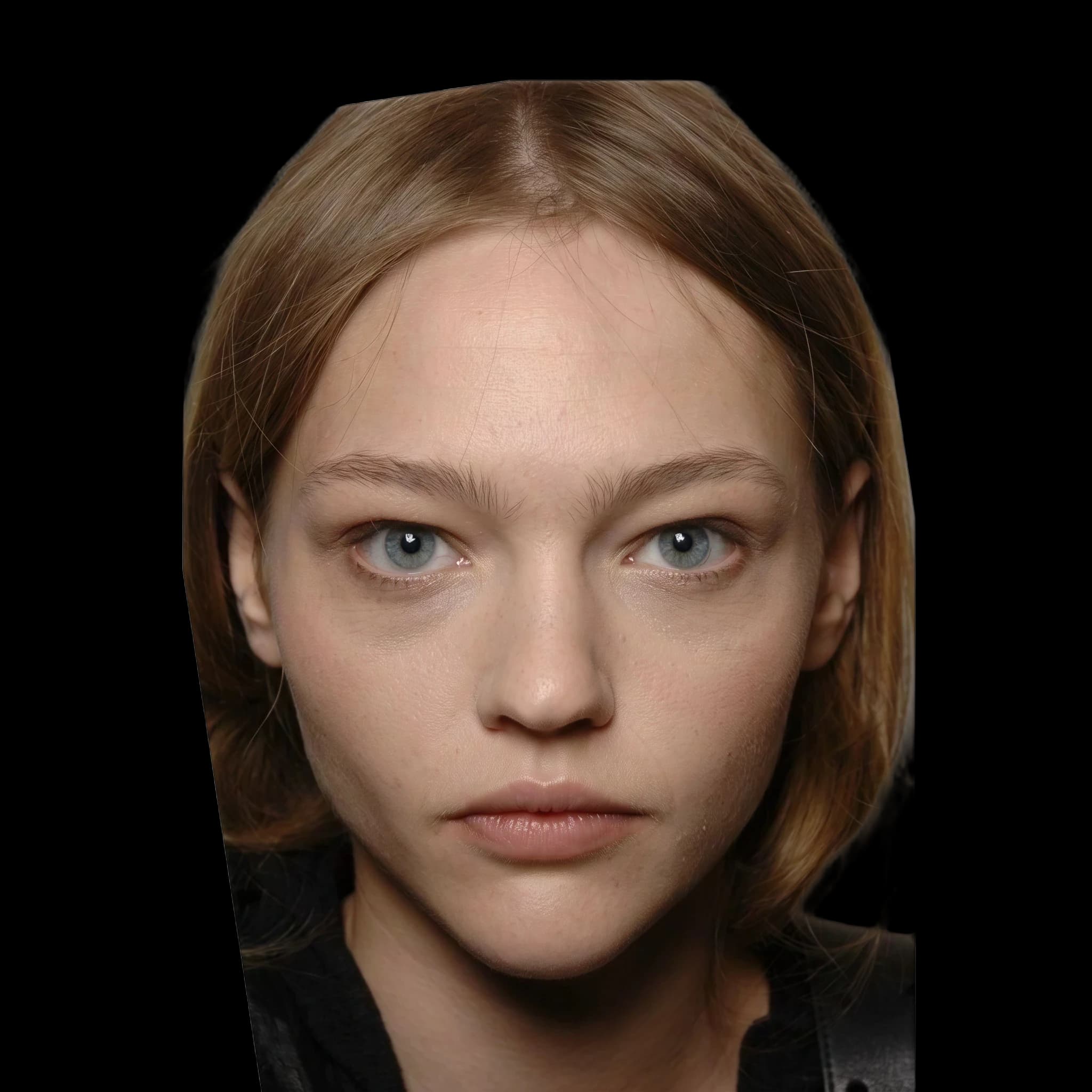 Sasha Pivovarova, Hyperpigmentation
