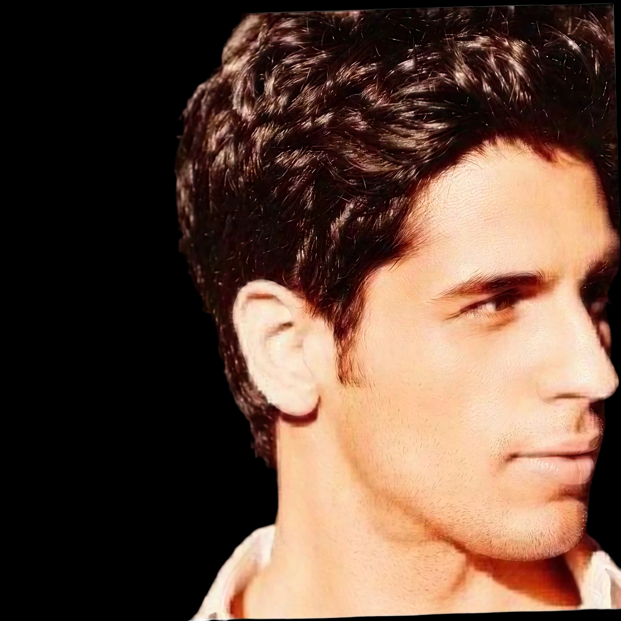Sidharth Malhotra, Upper Lip E-Line Position
