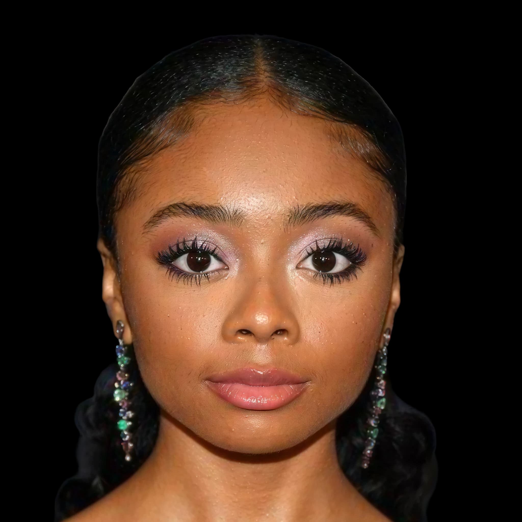 Skai Jackson, Hyperpigmentation