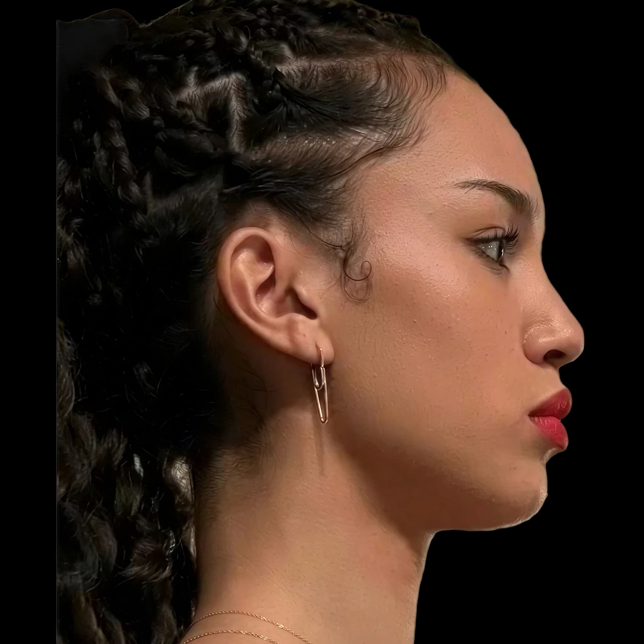 Sofia Wylie, Submental Definition