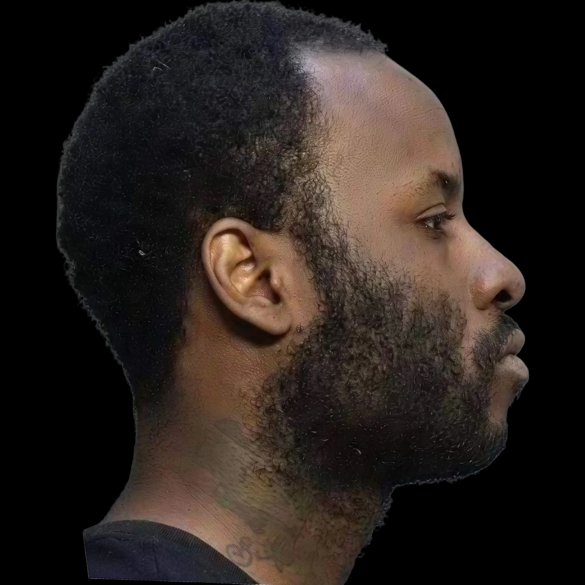 Spaceghostpurrp, Nasal Tip Angle