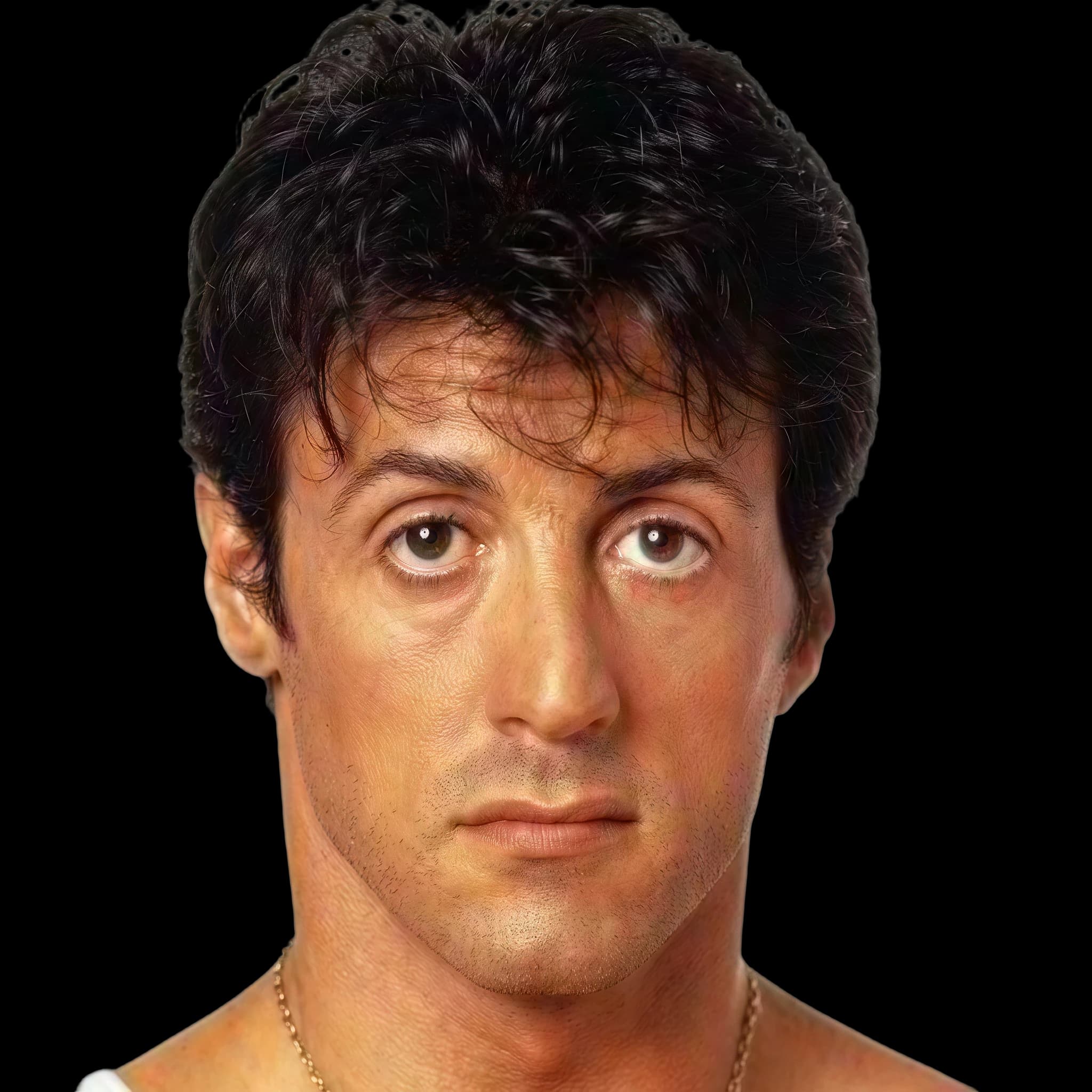 Sylvester Stallone, Hyperpigmentation
