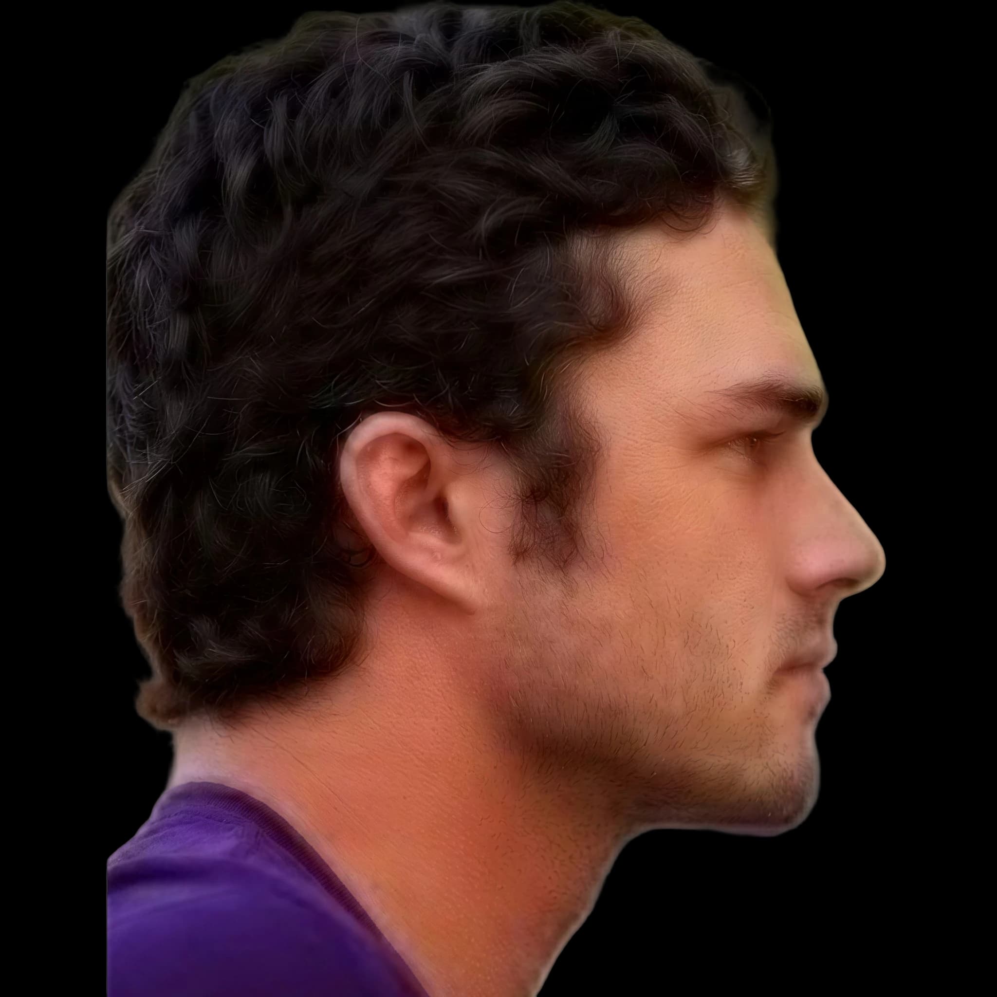 Taylor Kinney, Submental Definition