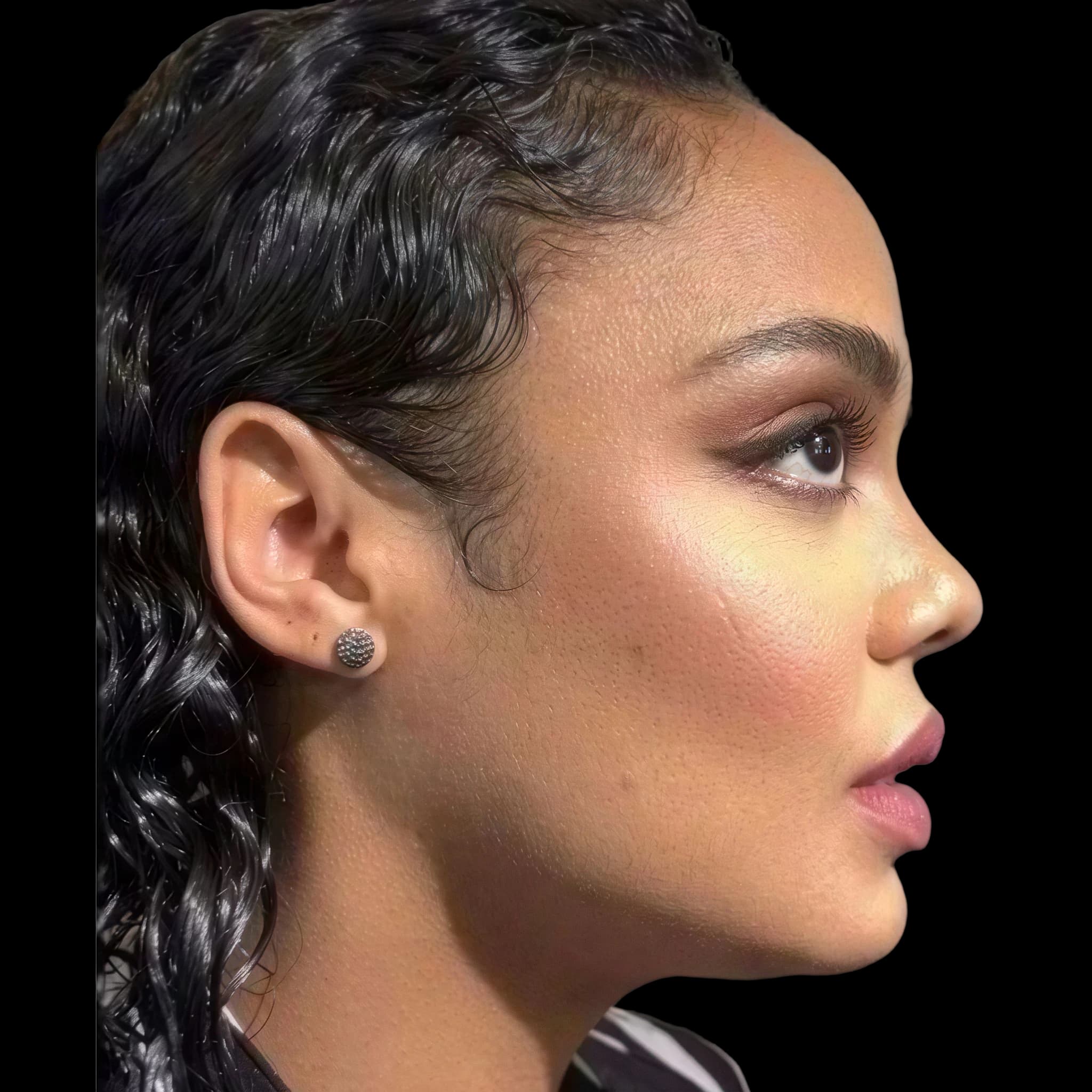 Tessa Thompson, Submental Definition