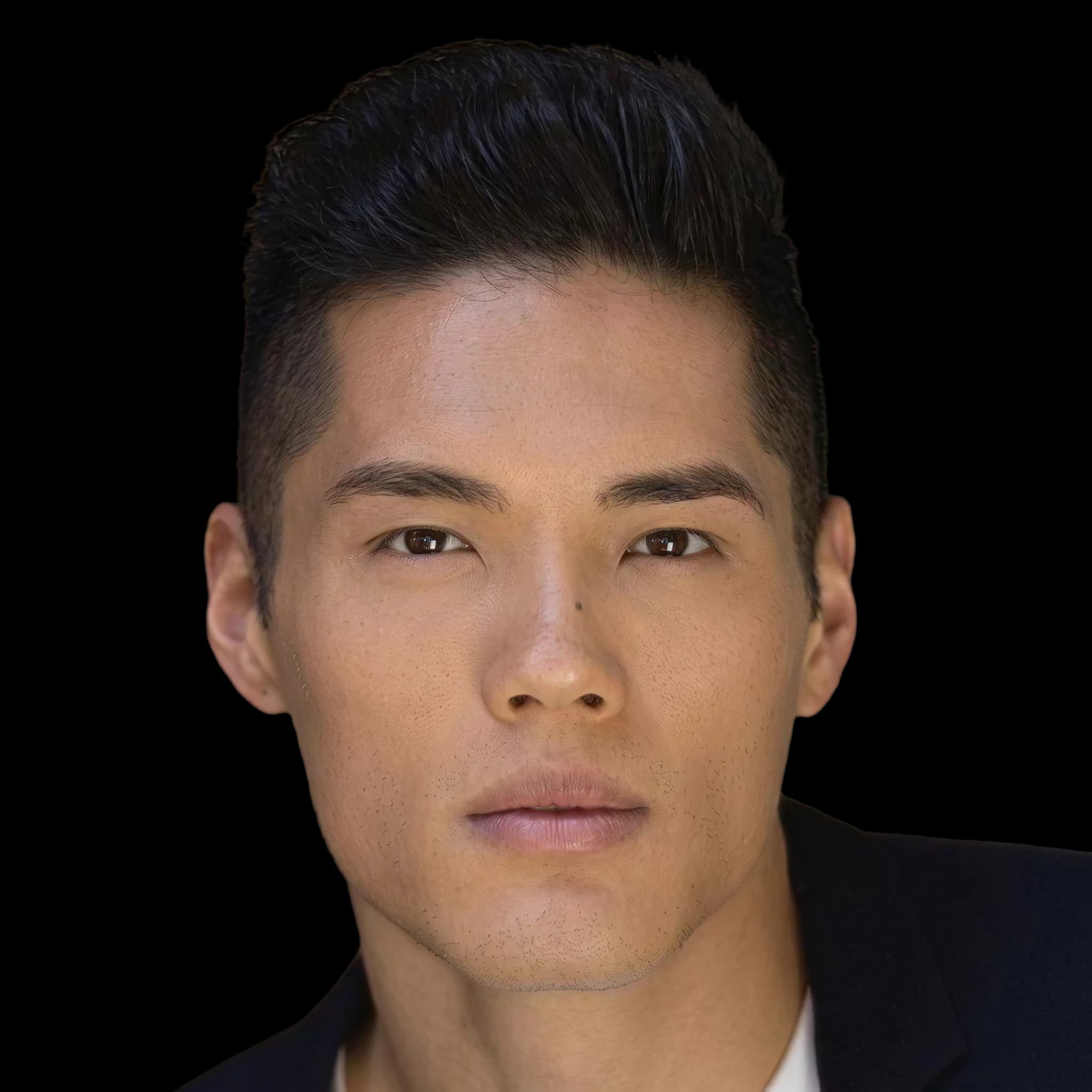 Tim Chung, Cheekbone Prominence