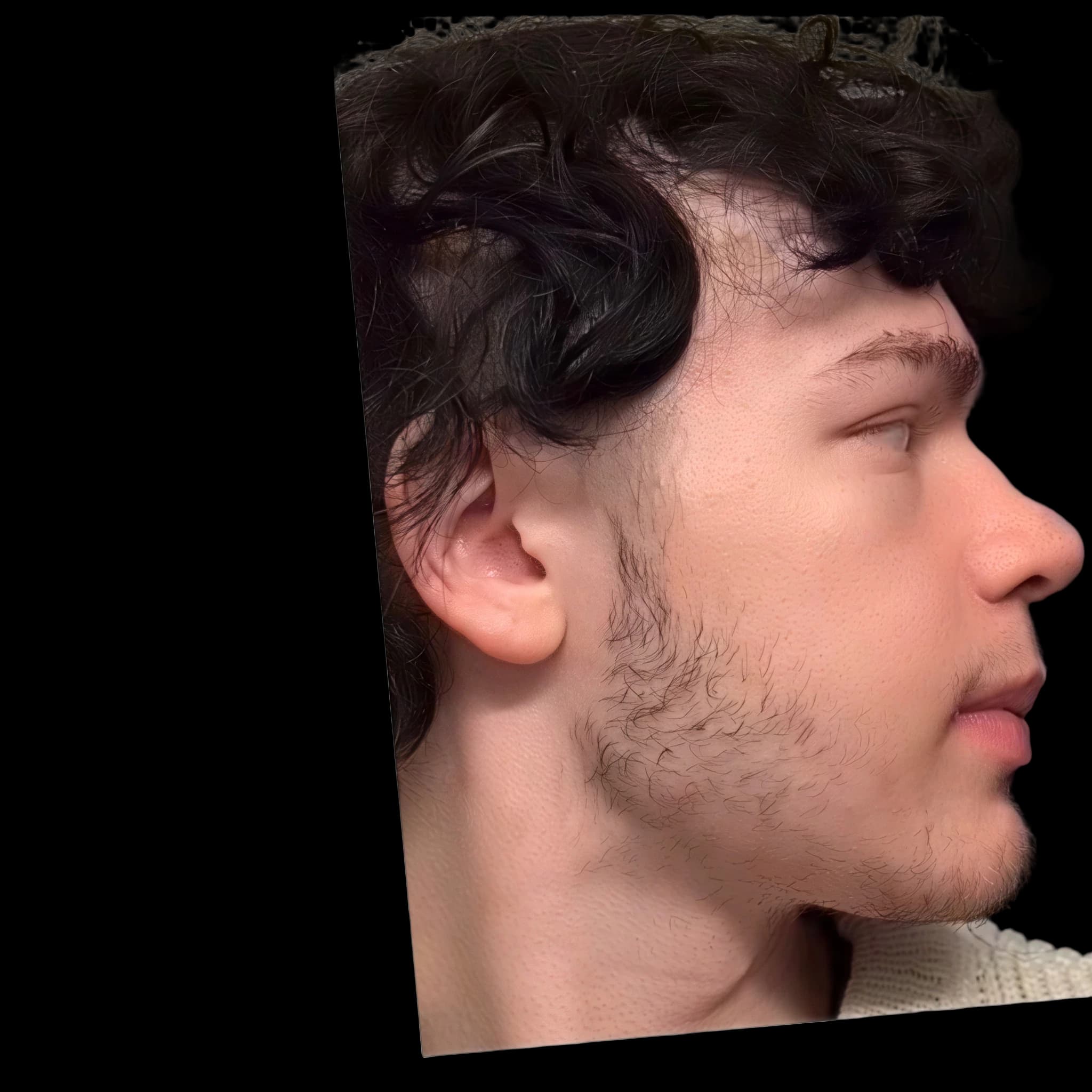 Timothy Haireth (Post Op), Orbital Vector
