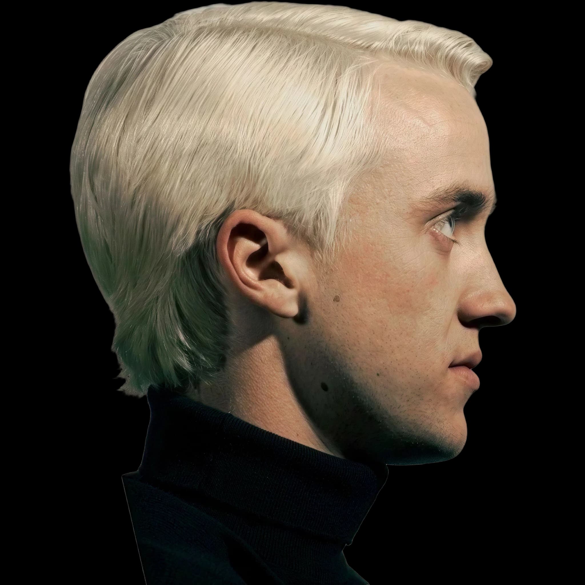 Tom Felton, Eye Protrusion