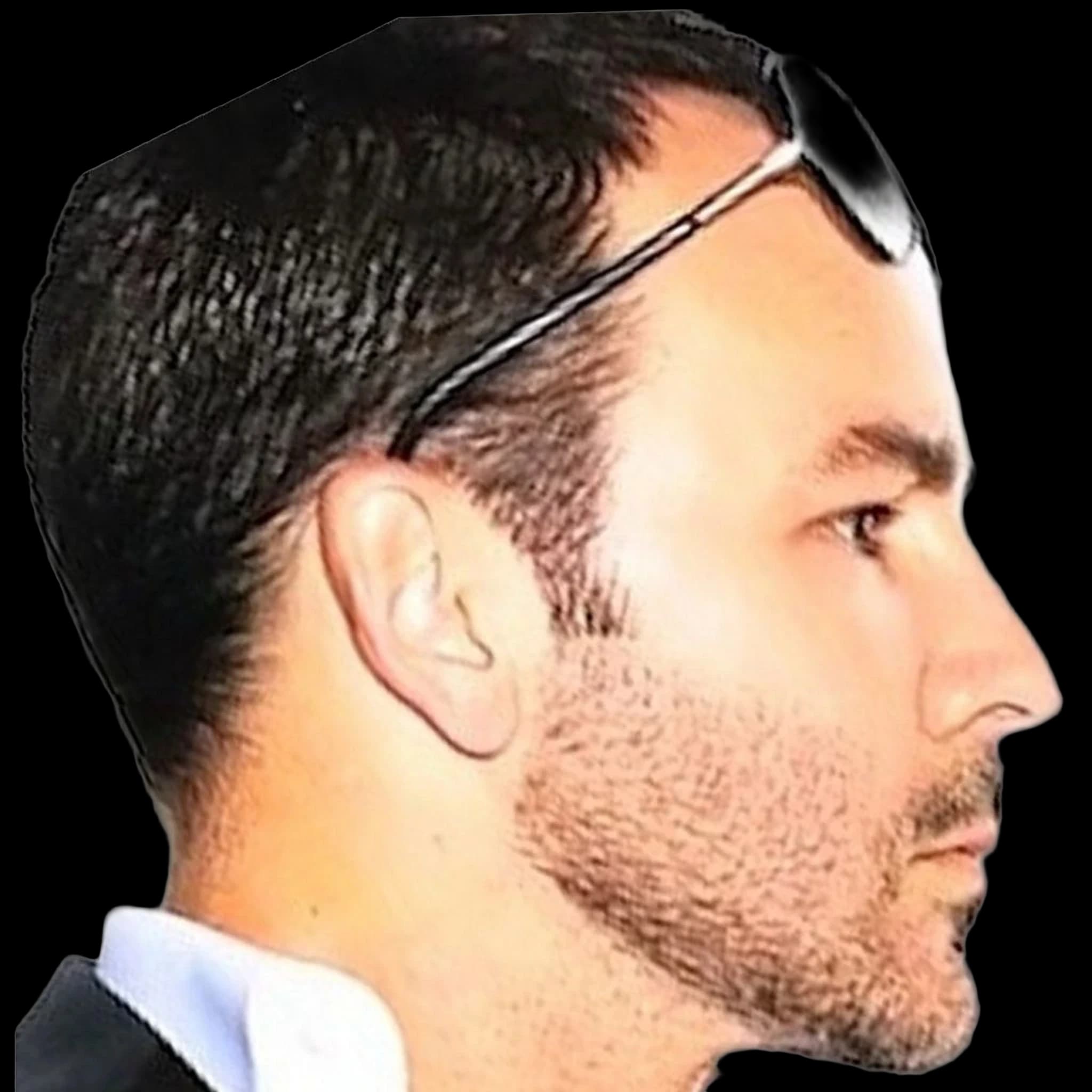 Tom Ford, Eye Protrusion