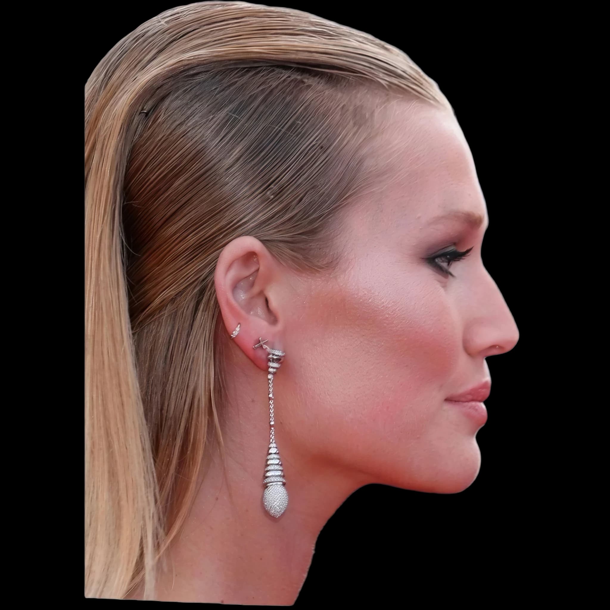 Toni Garrn, Submental Definition