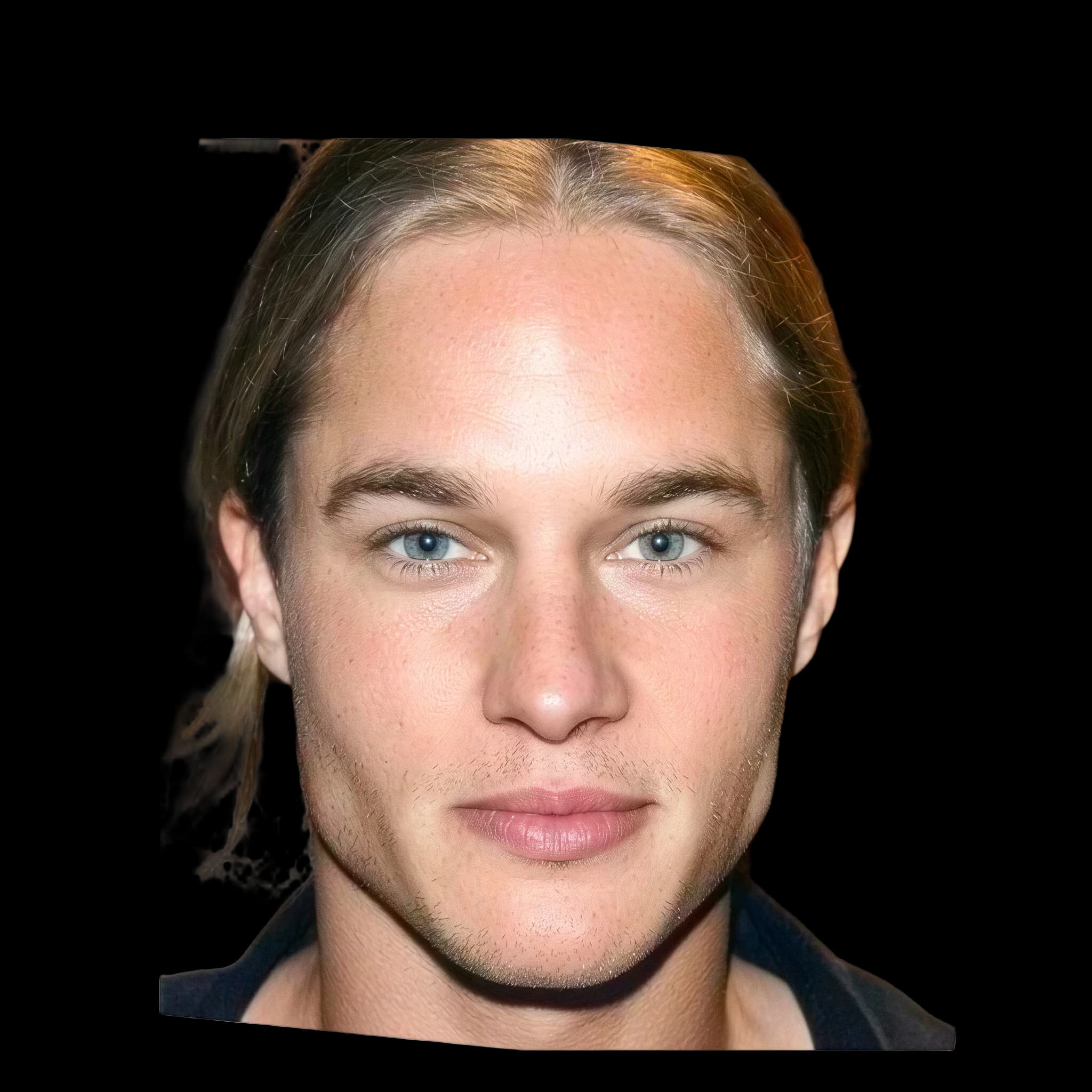 Travis Fimmel, Rosacea