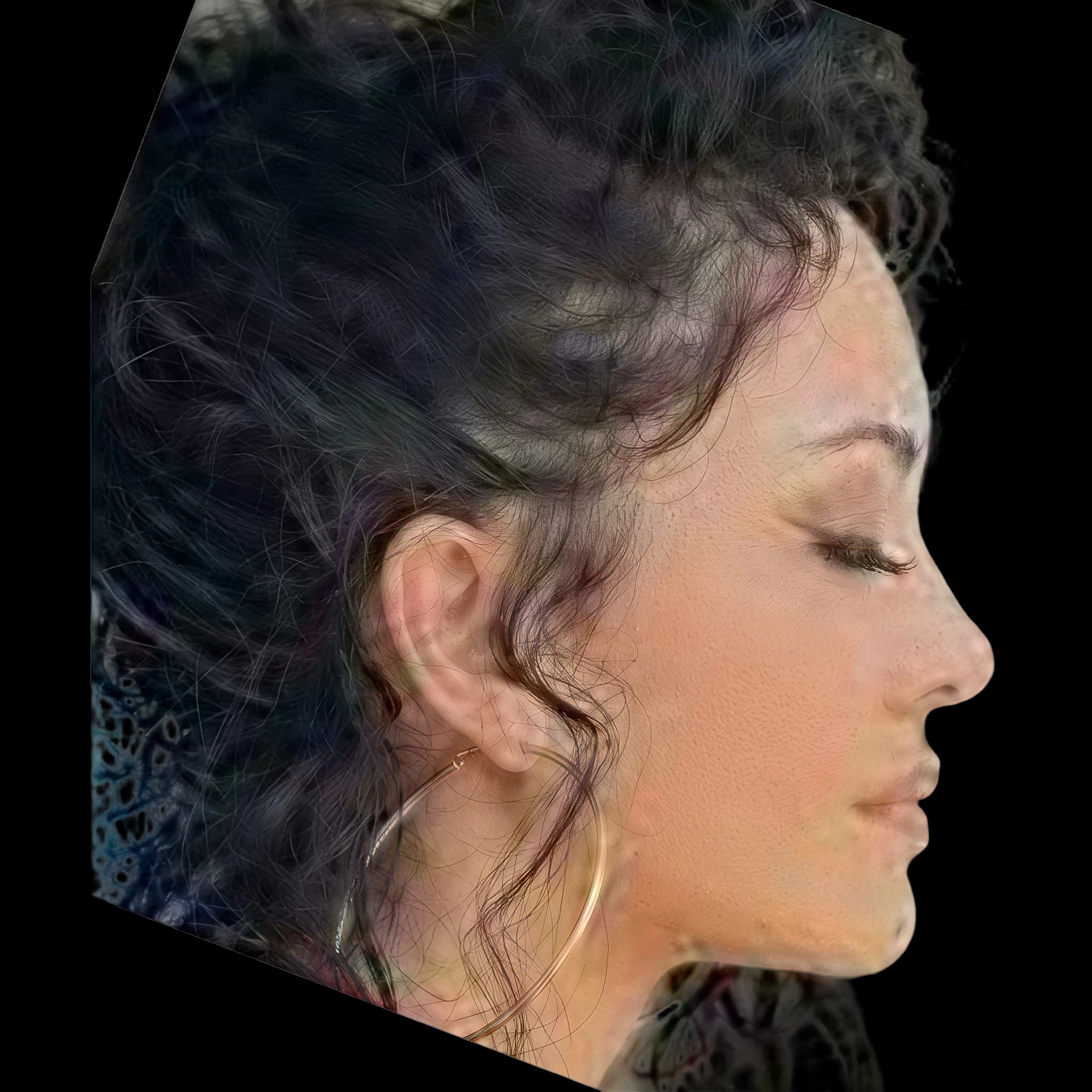 Tristin Mays, Nasofrontal Angle