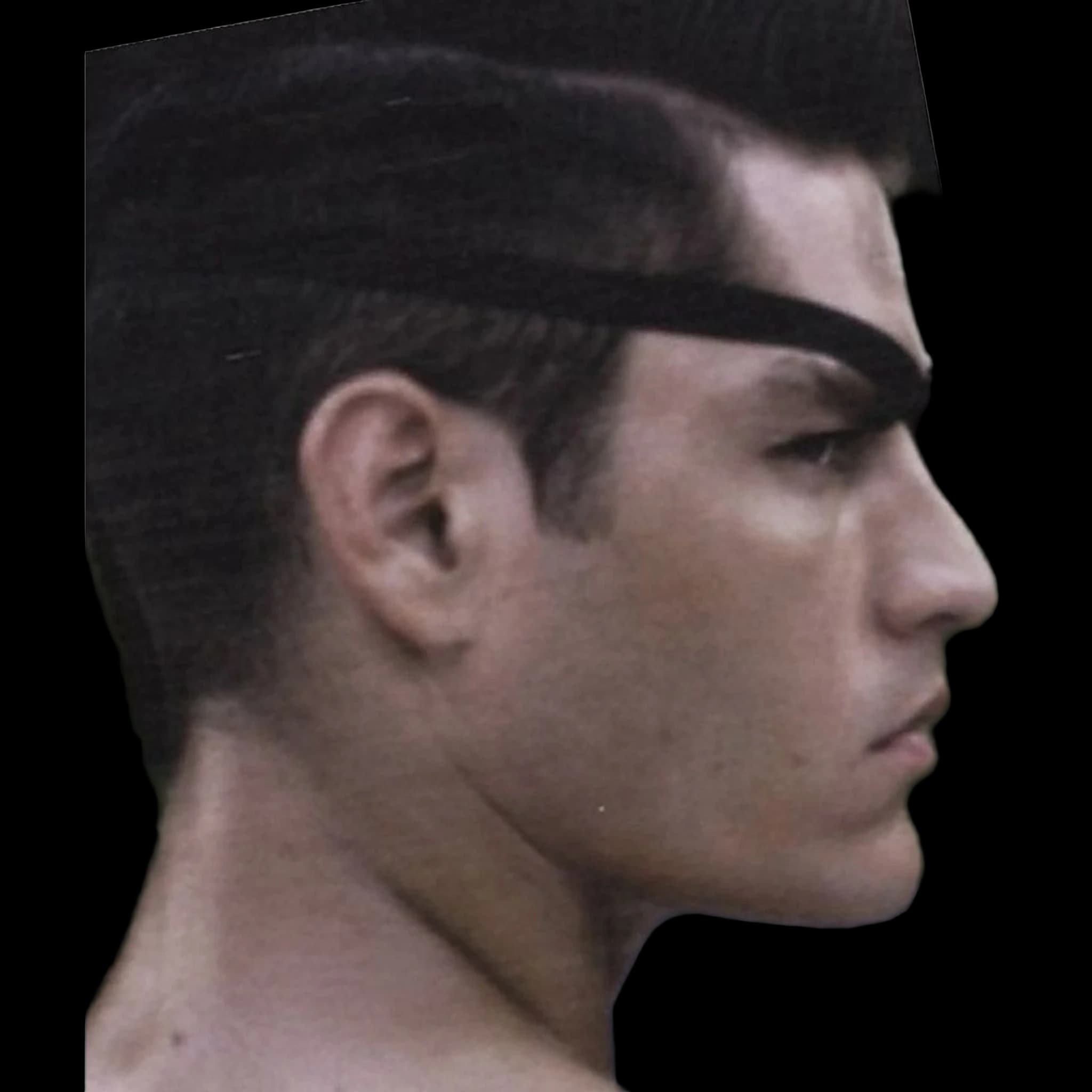 Tyson Ballou, Submental Definition