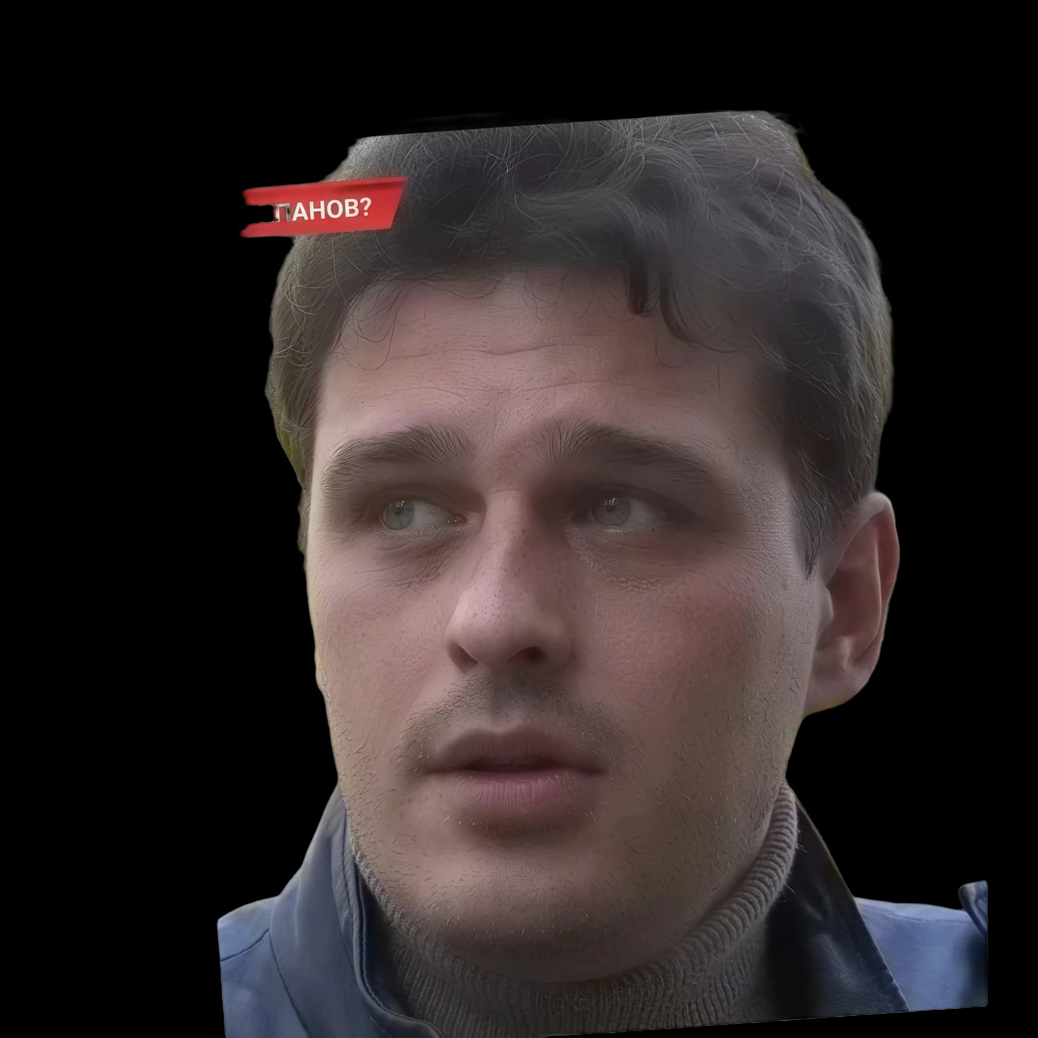 Vasiliy Stepanov (current), Hyperpigmentation