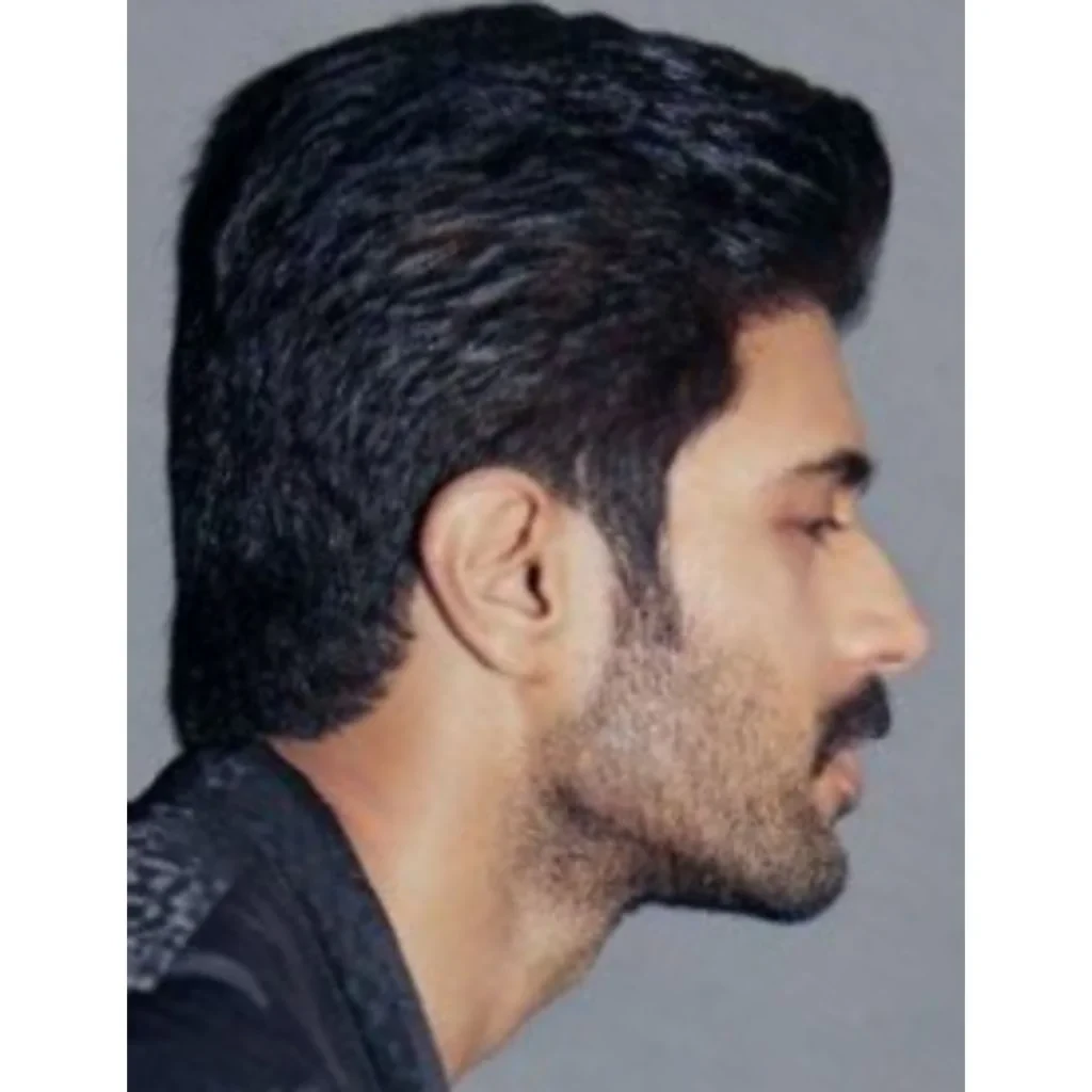 Vijay Deverakonda