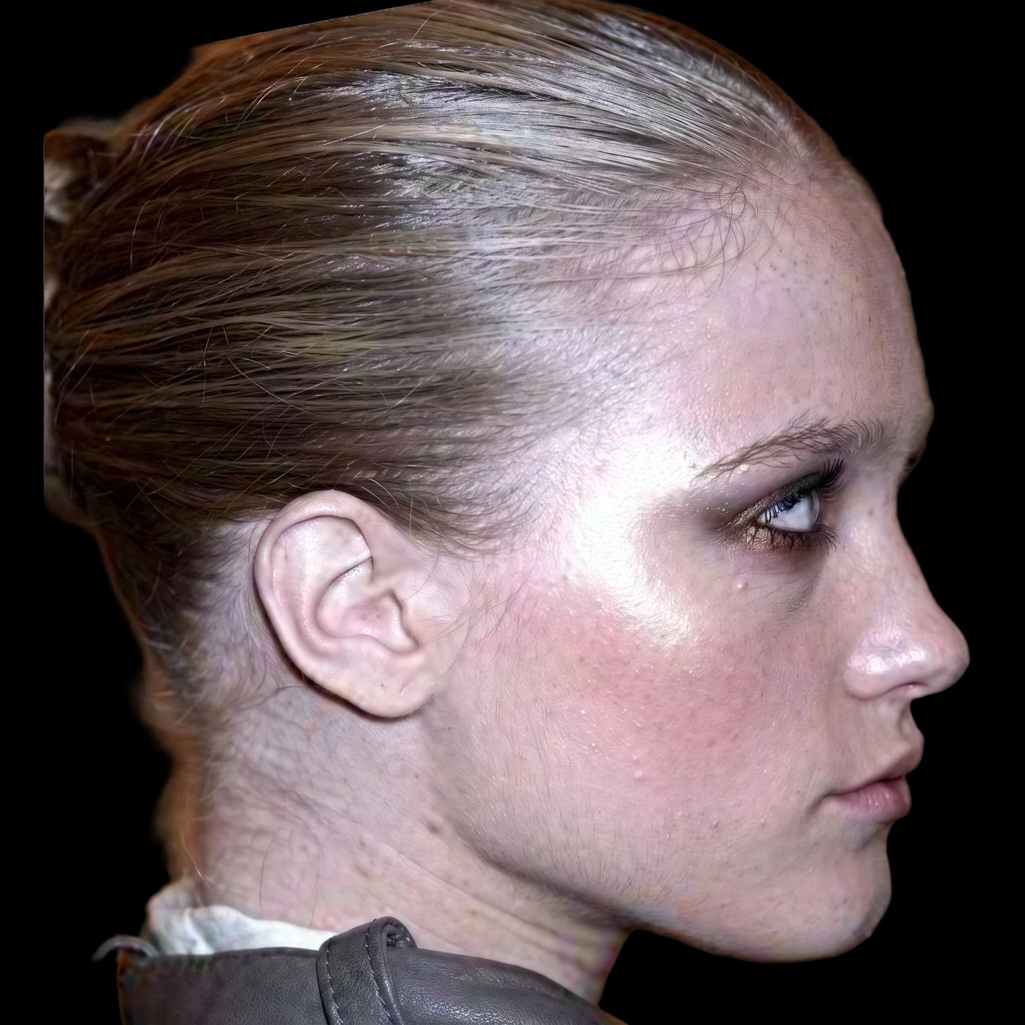 Vlada Roslyakova, Mentolabial Angle