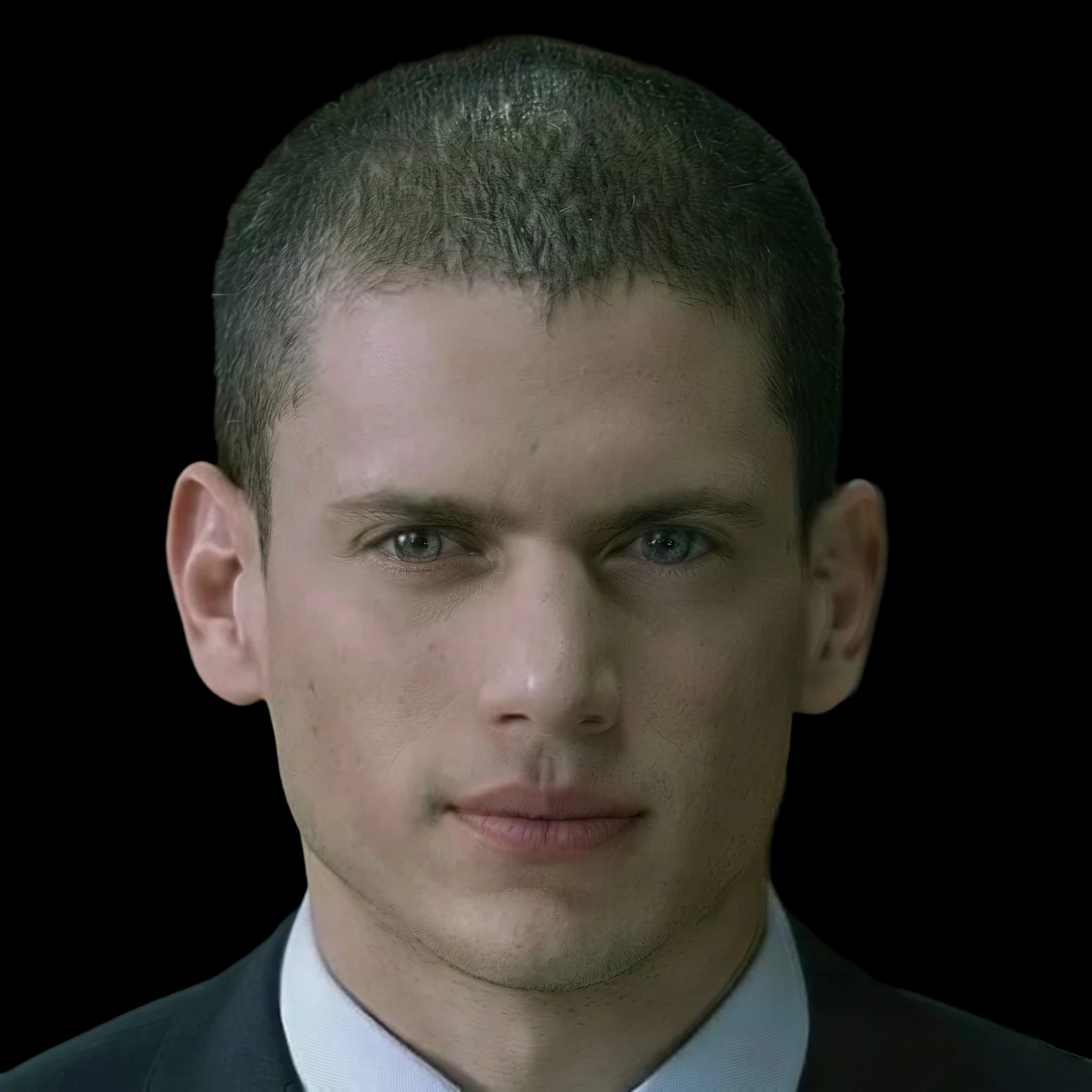 Wentworth Miller, Hyperpigmentation