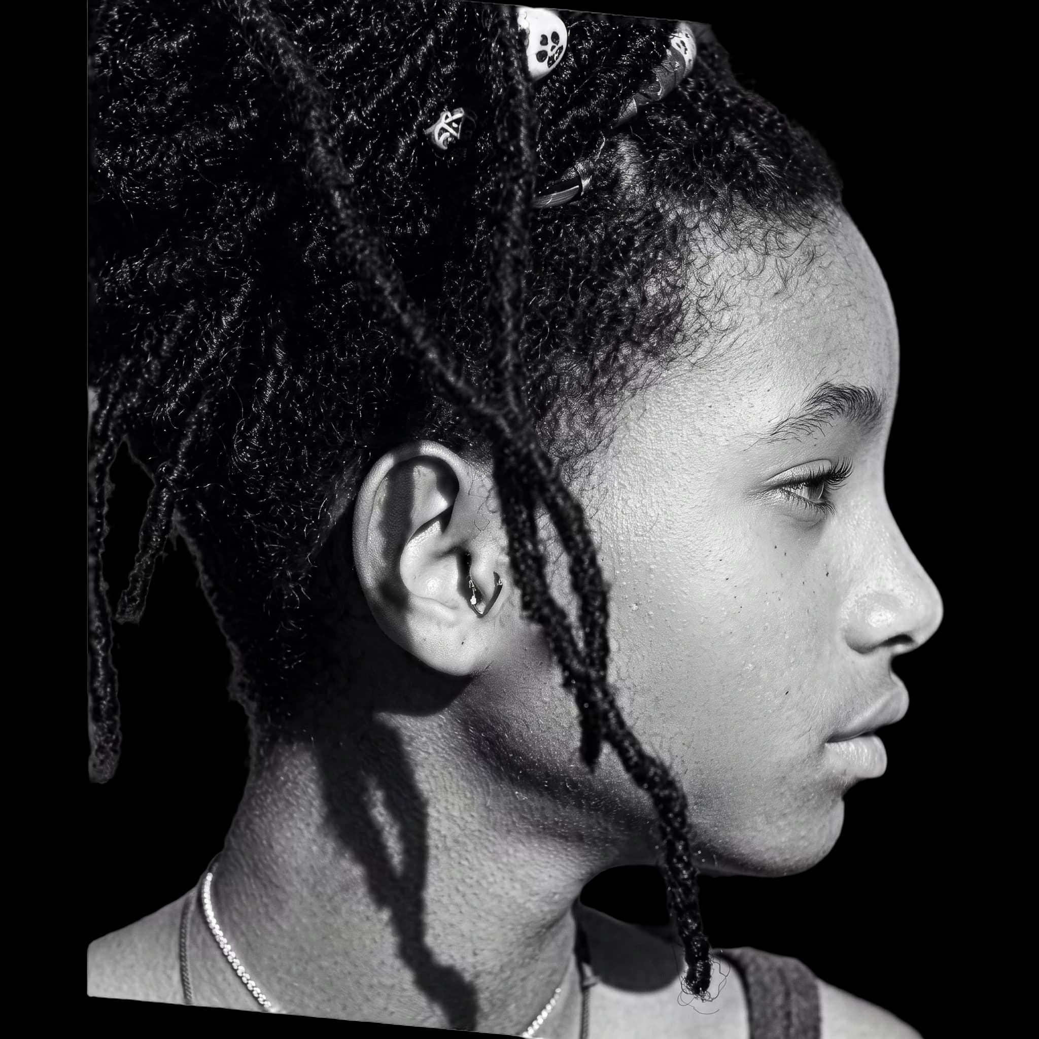 Willow Smith, Upper Lip Burstone Line