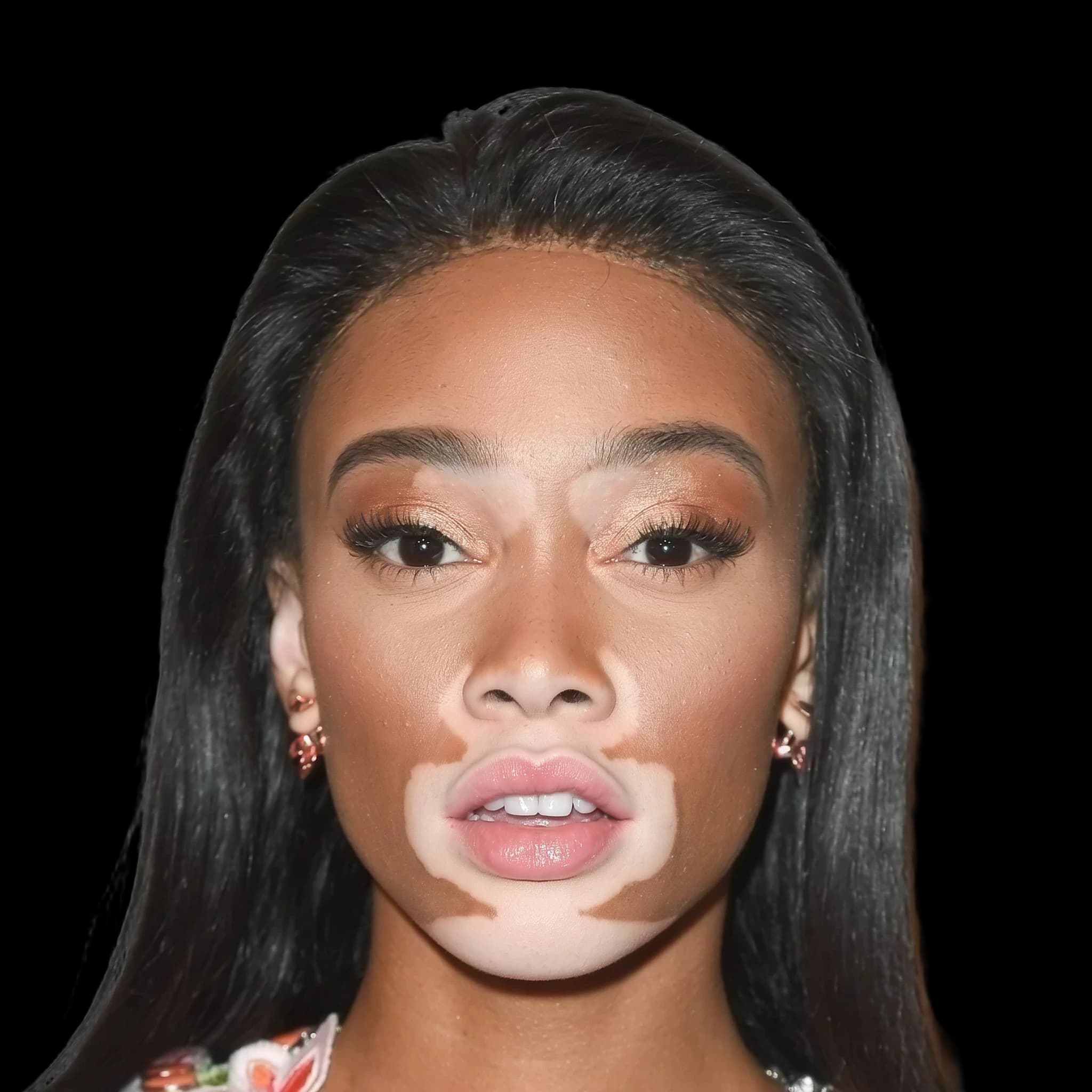 Winnie Harlow, Intercanthal-Nasal Width Ratio