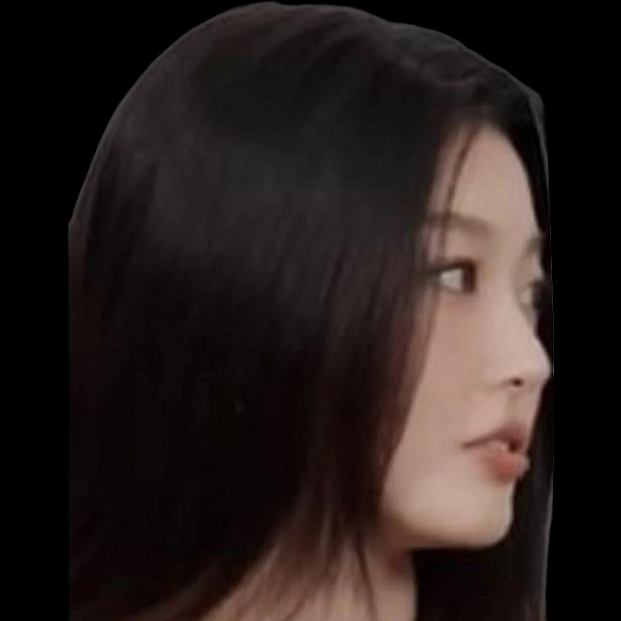 Yoonchae Jeung, Nasolabial Angle