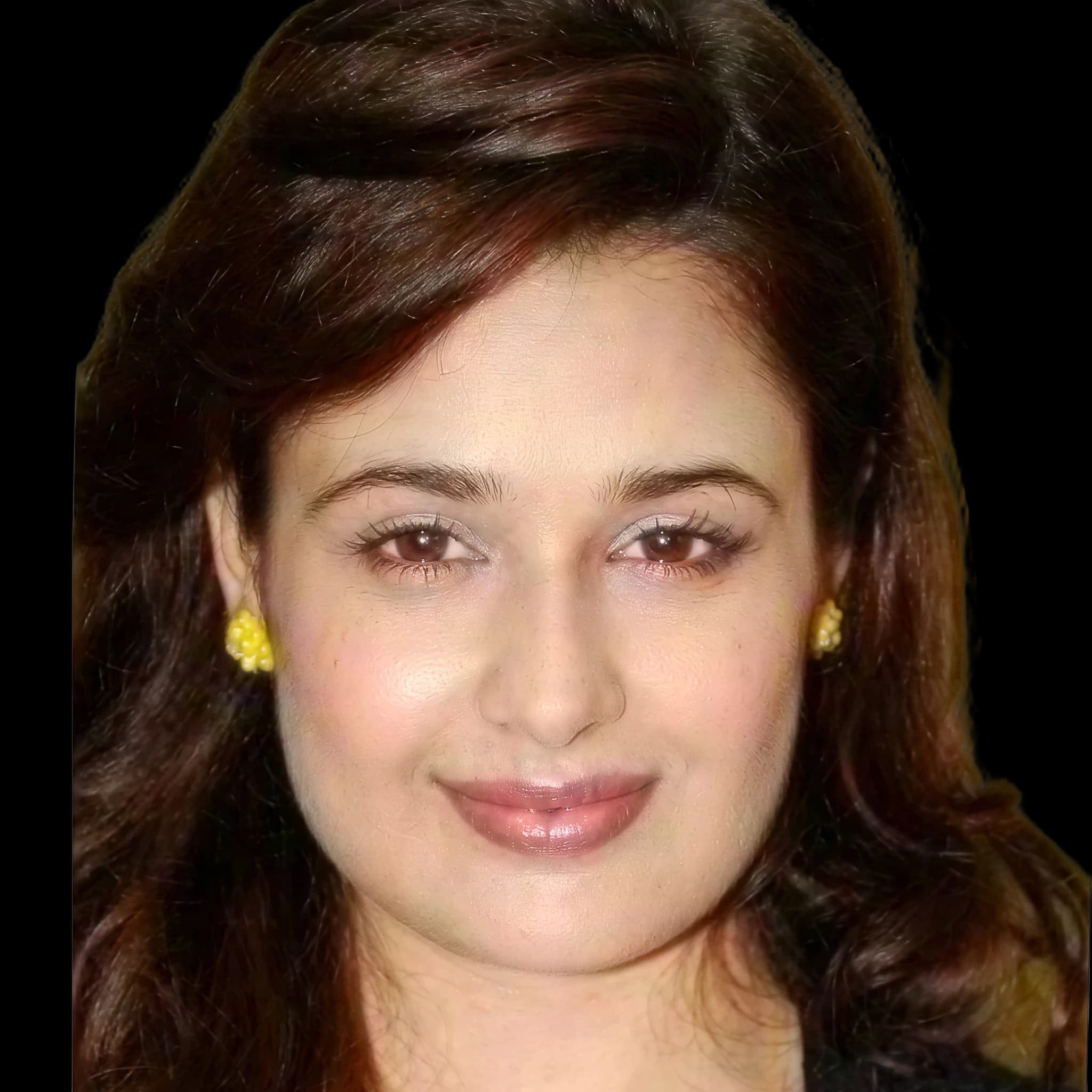 Yuvika Chaudhary, Hyperpigmentation
