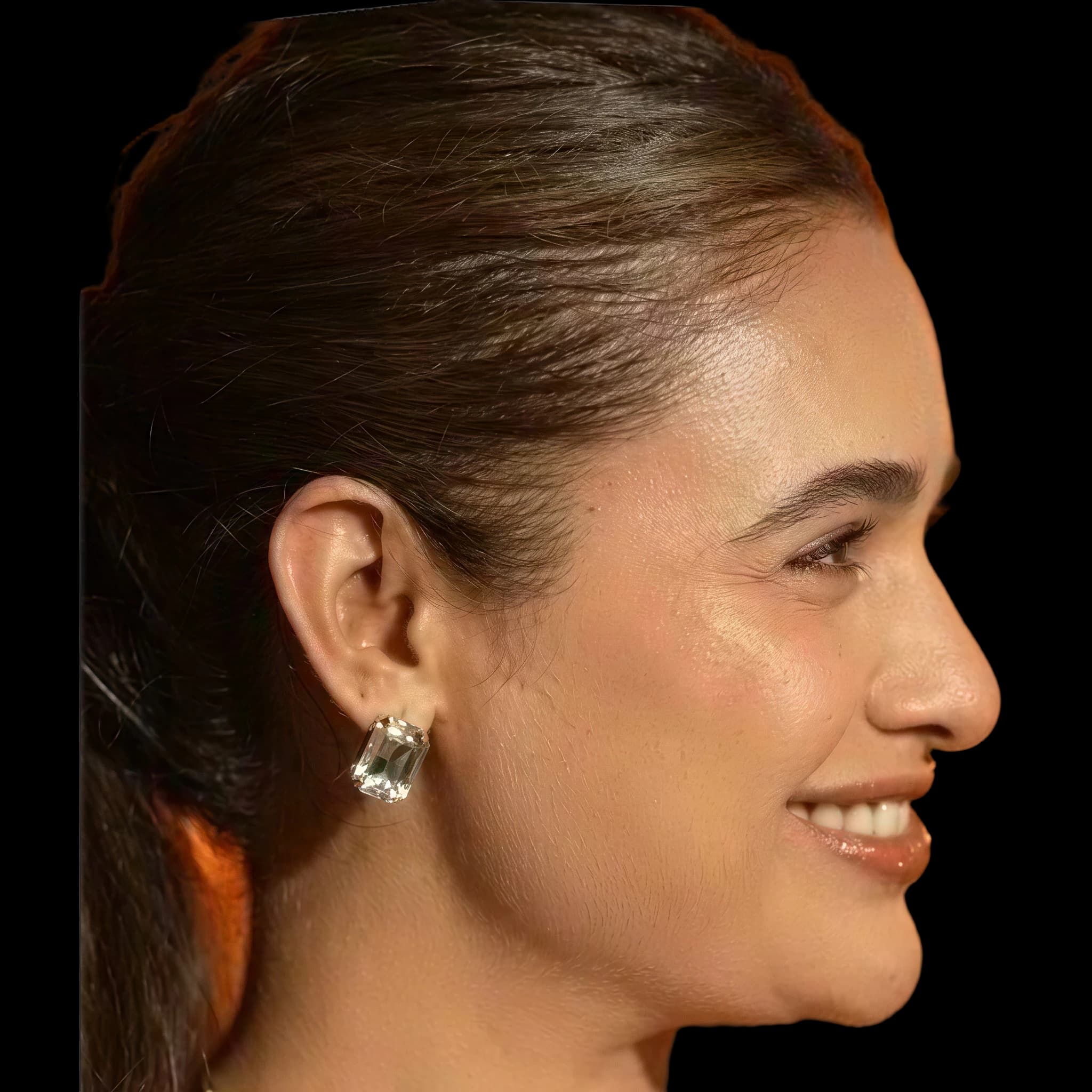 Yuvika Chaudhary, Submental Definition