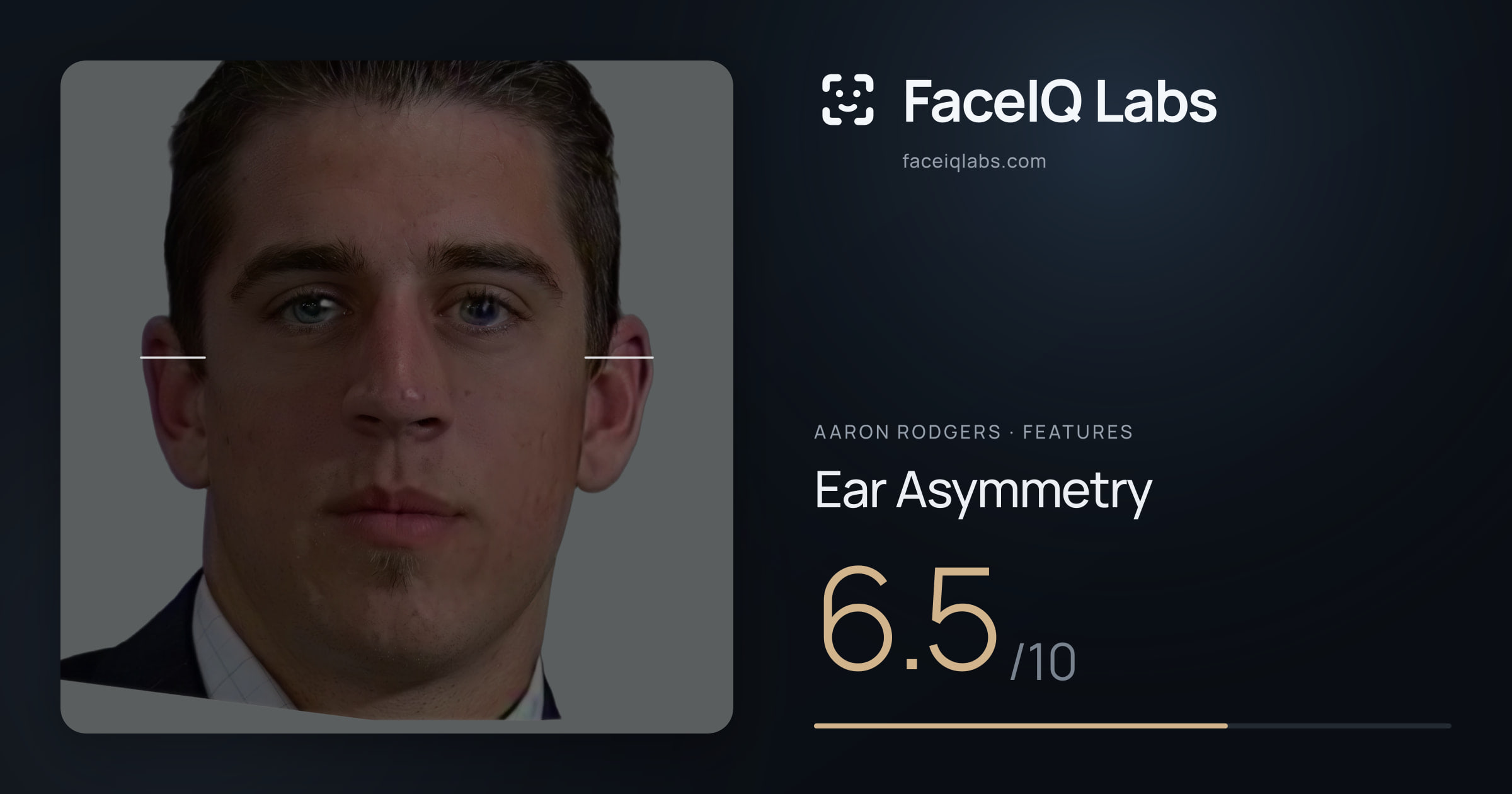 Aaron Rodgers Ear Asymmetry: 6.5/10, drawn on the photo