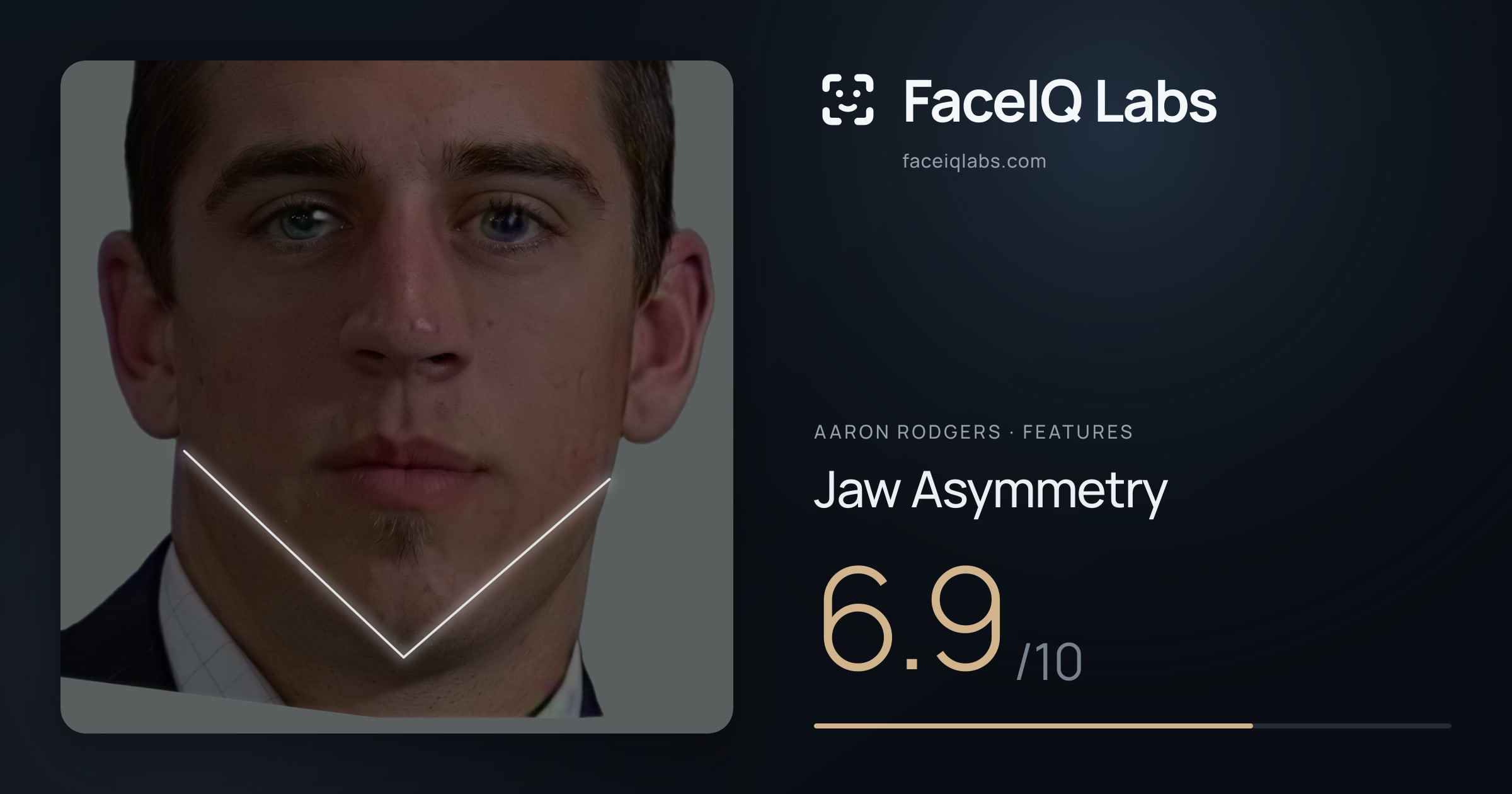 Aaron Rodgers Jaw Asymmetry: 6.9/10, drawn on the photo