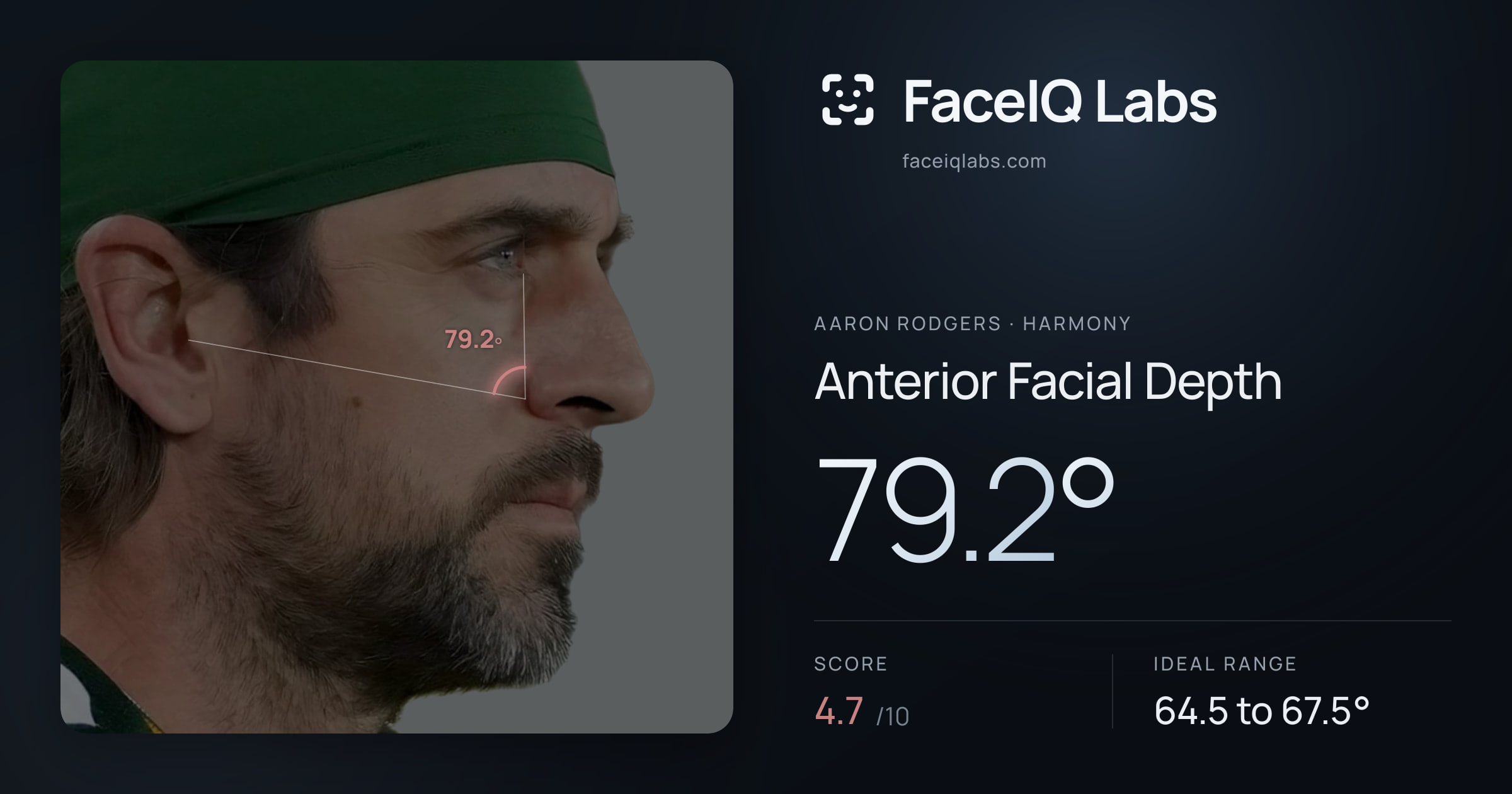 Aaron Rodgers Anterior Facial Depth: 79.2°, drawn on the photo