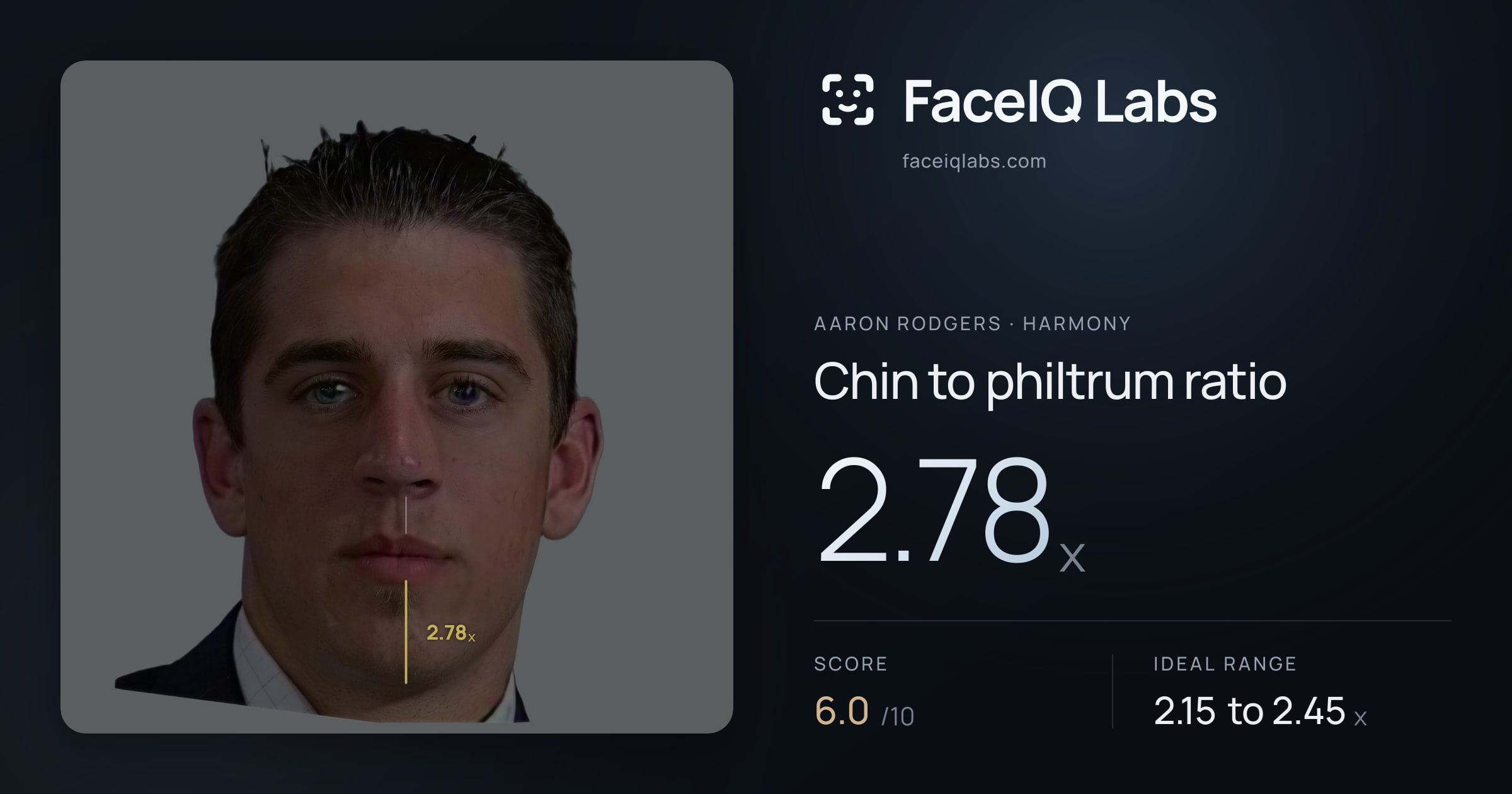 Aaron Rodgers Chin to philtrum ratio: 2.78x, drawn on the photo