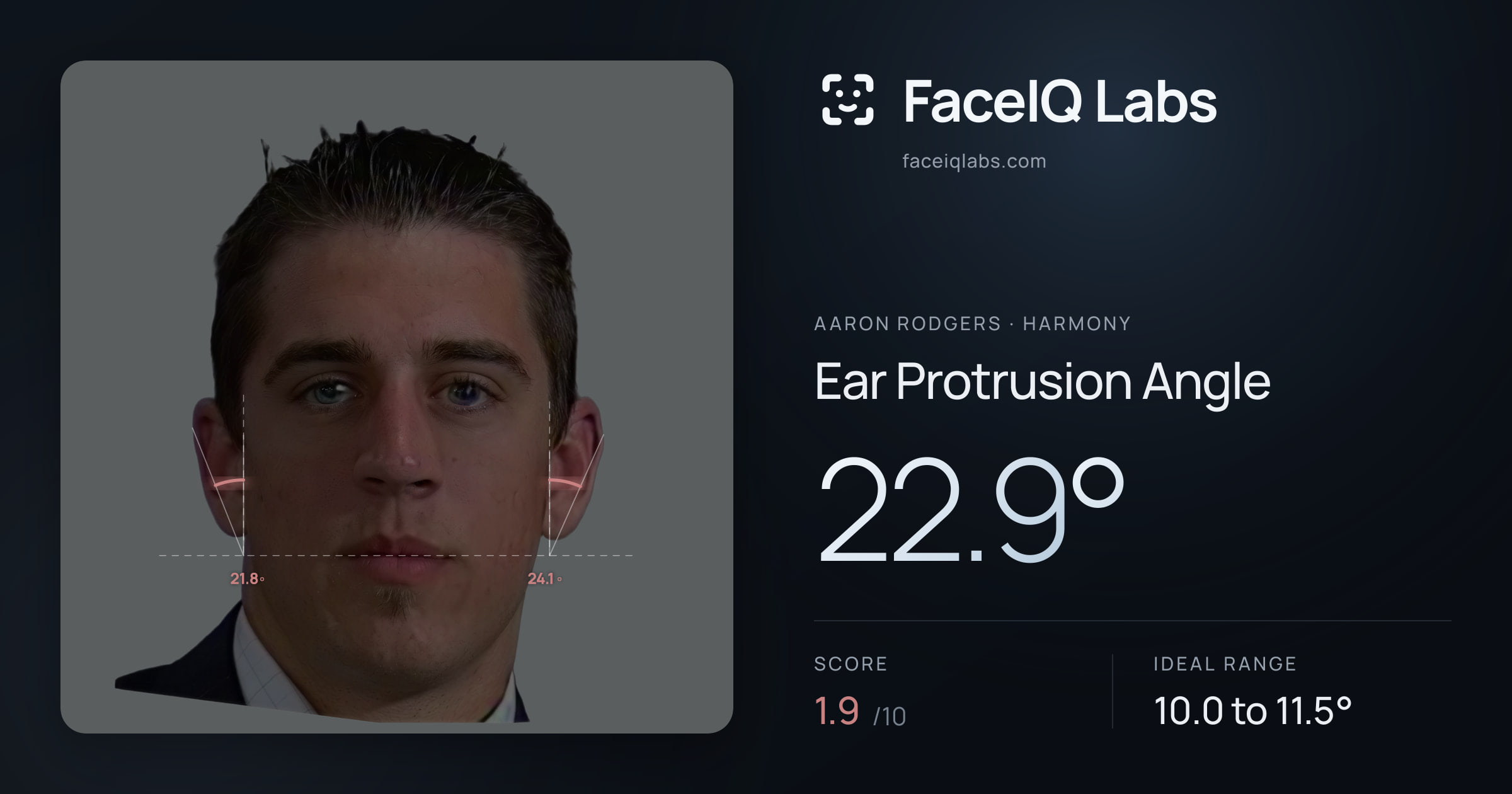 Aaron Rodgers Ear Protrusion Angle: 22.9°, drawn on the photo