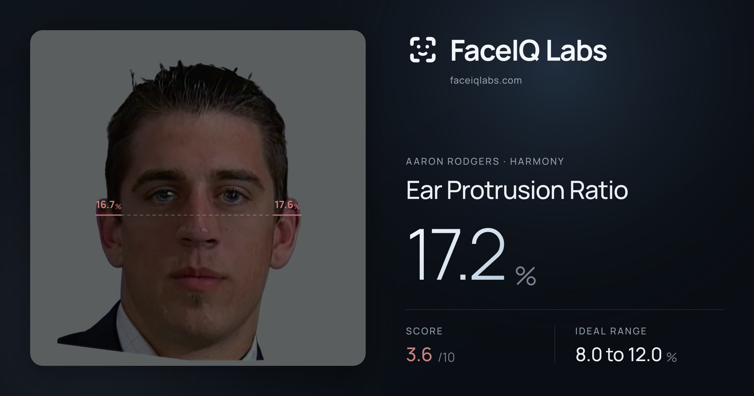 Aaron Rodgers Ear Protrusion Ratio: 17.2%, drawn on the photo