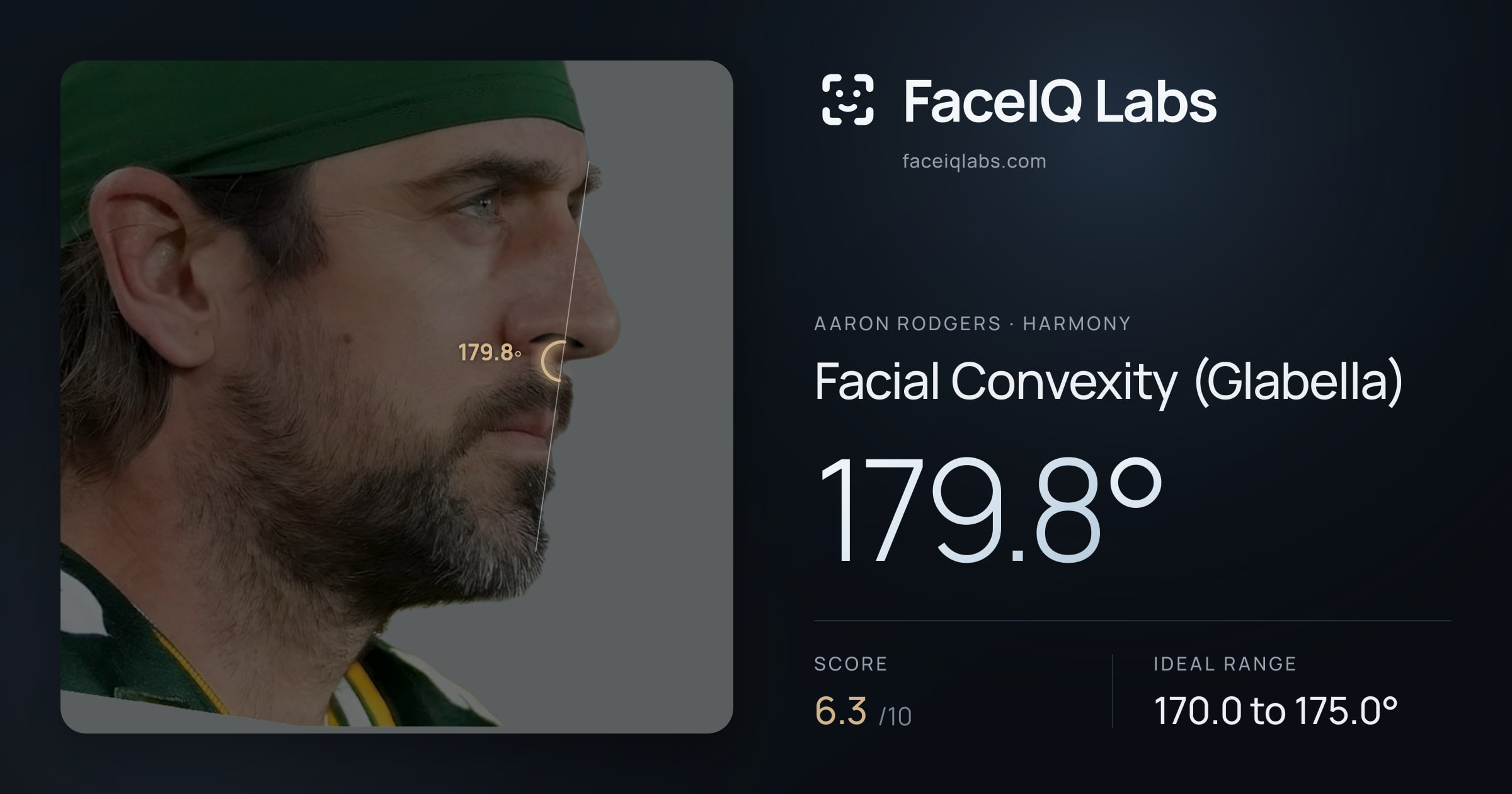 Aaron Rodgers Facial Convexity (Glabella): 179.8°, drawn on the photo
