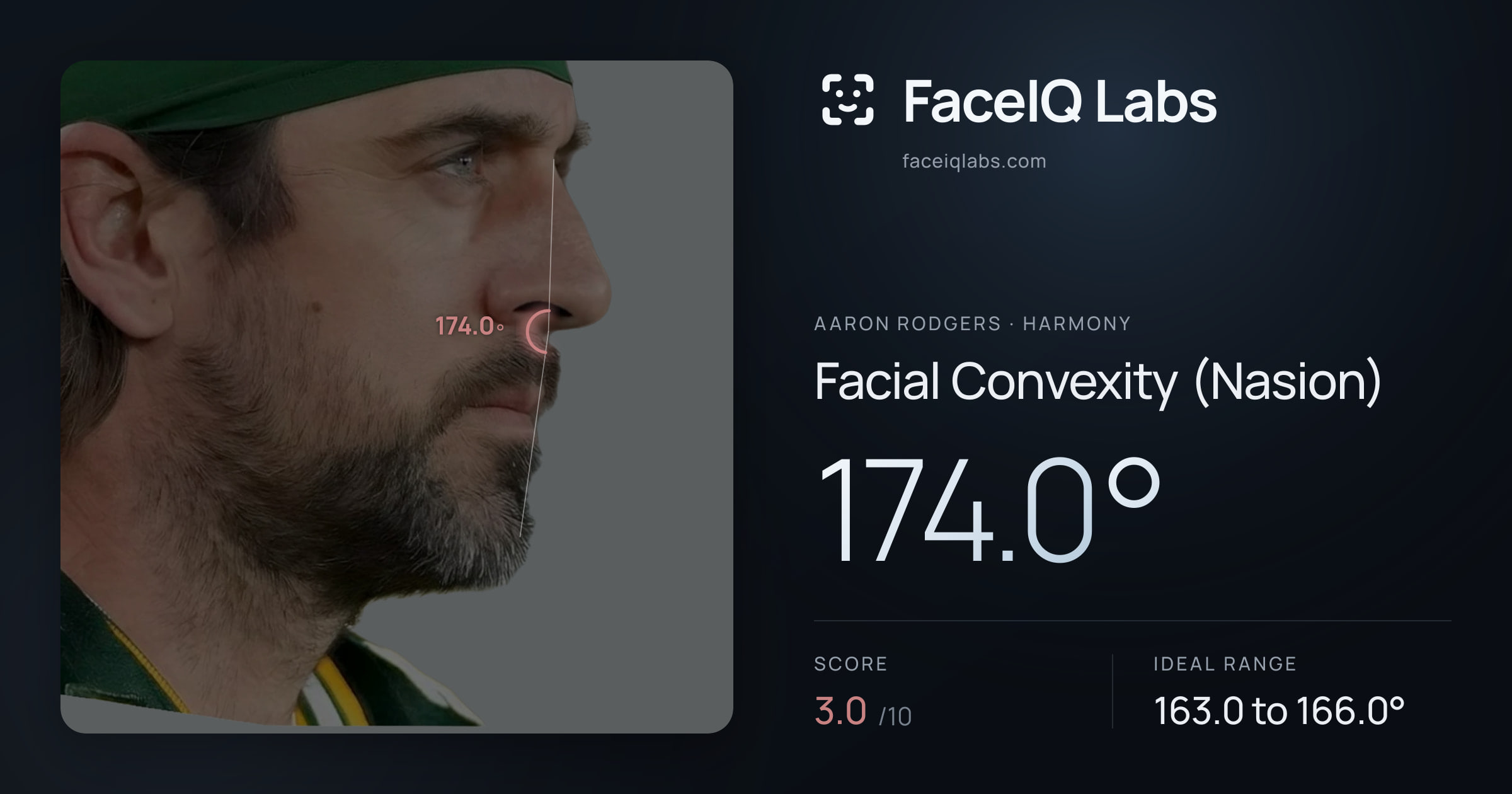 Aaron Rodgers Facial Convexity (Nasion): 174.0°, drawn on the photo