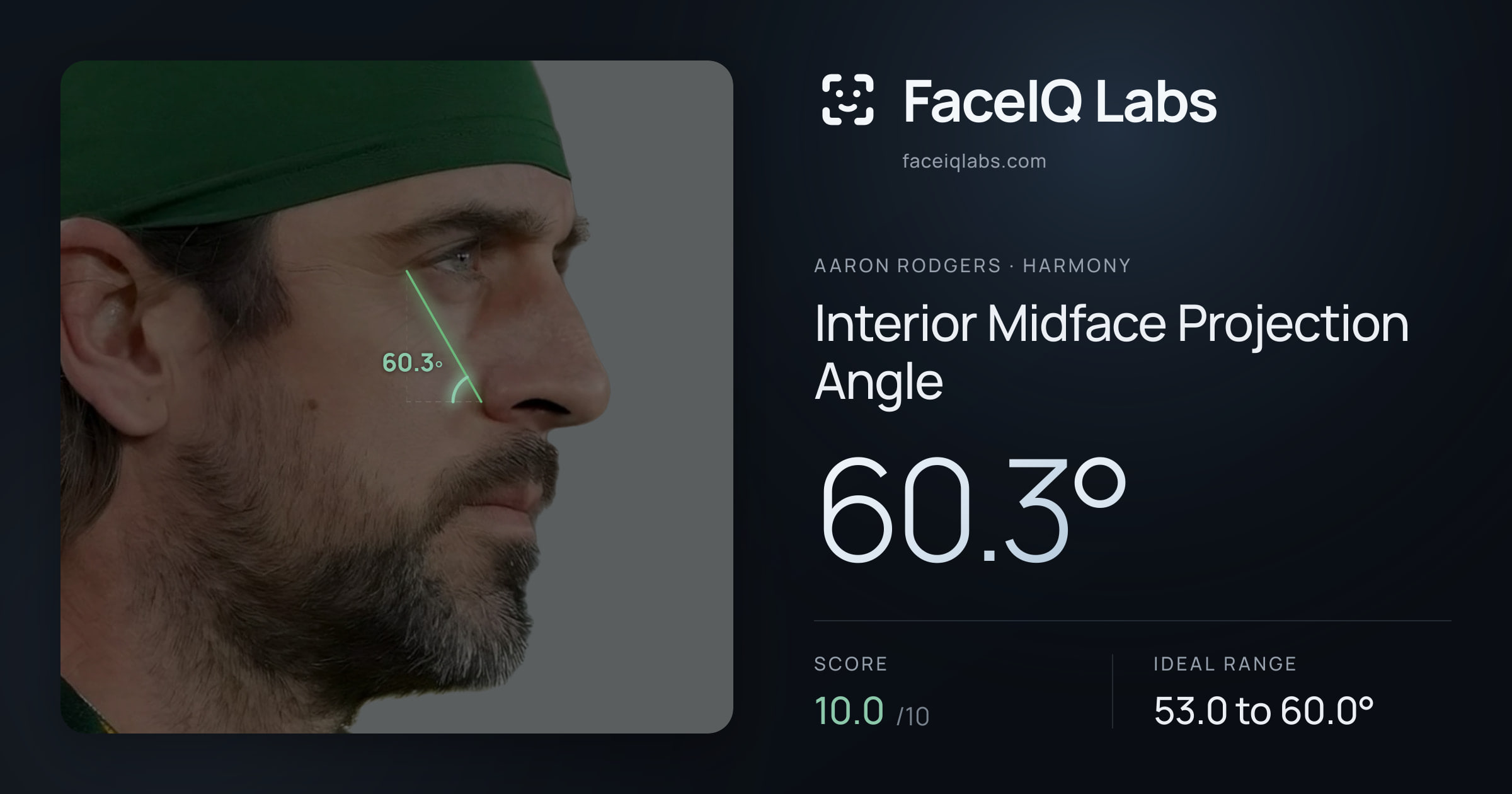 Aaron Rodgers Interior Midface Projection Angle: 60.3°, drawn on the photo