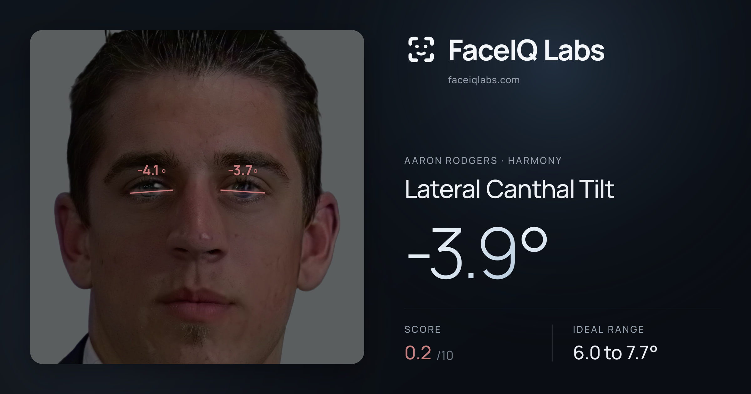Aaron Rodgers Lateral Canthal Tilt: -3.9°, drawn on the photo