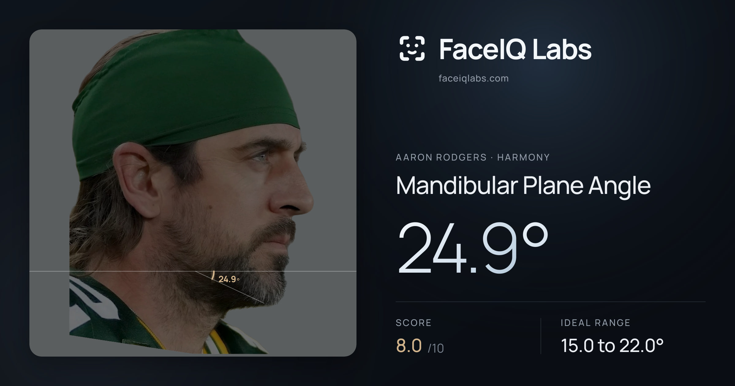 Aaron Rodgers Mandibular Plane Angle: 24.9°, drawn on the photo