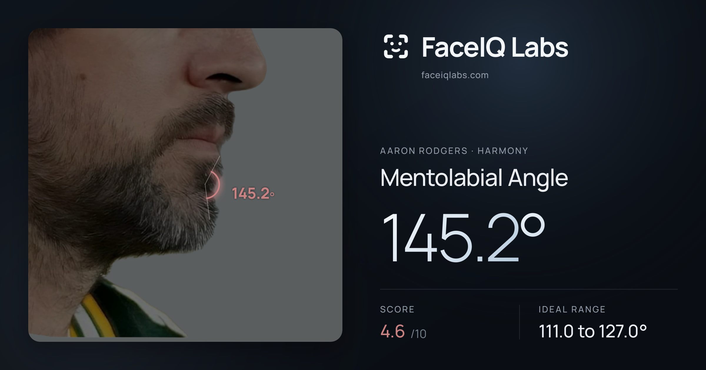 Aaron Rodgers Mentolabial Angle: 145.2°, drawn on the photo